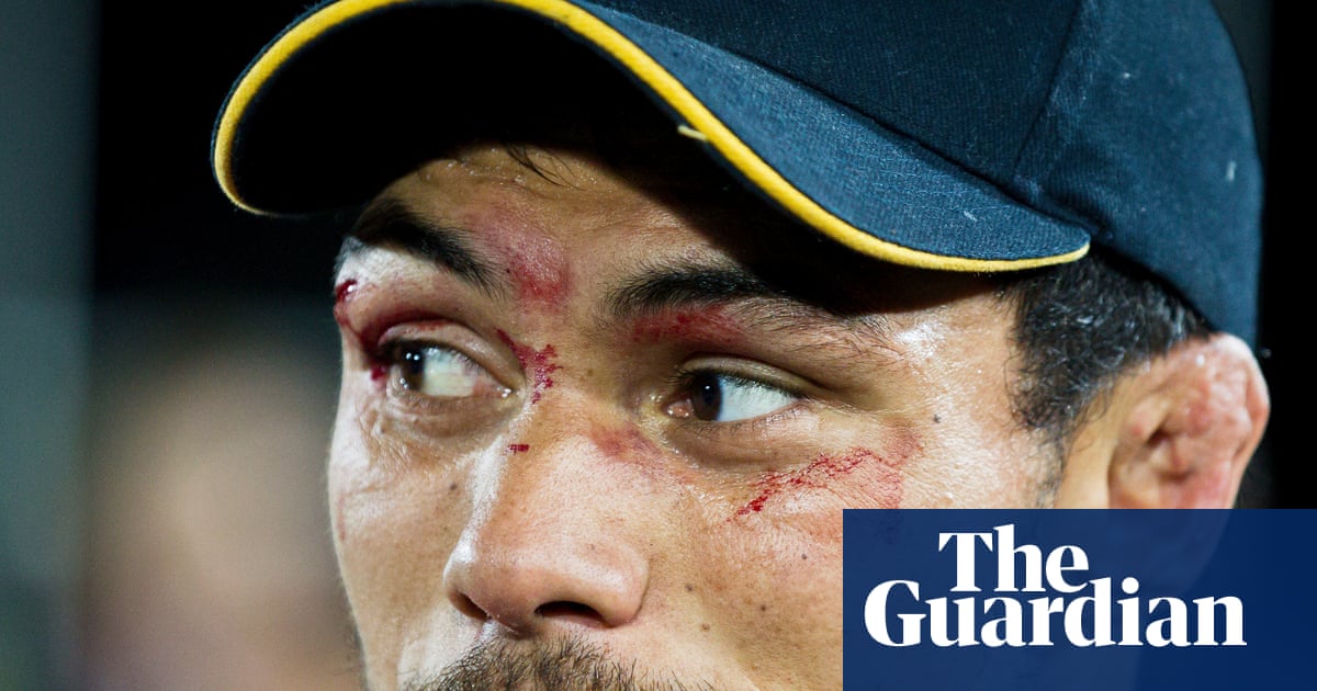 Shane Christie sofreu vários ferimentos na cabeça jogando rugby. Na morte, ele ainda está lutando pela mudança | Nova Zelândia