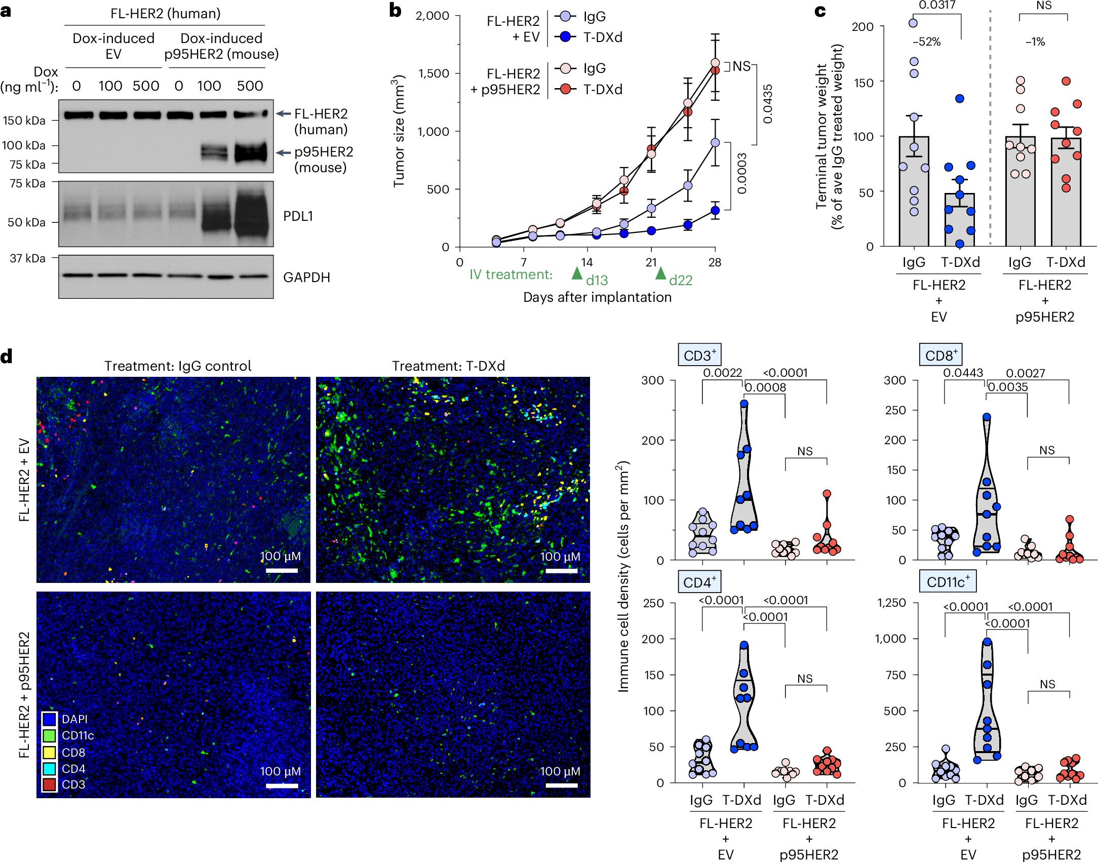 A descoberta do mecanismo de resistência ao tratamento do câncer de mama pode levar a uma nova esperança para alguns