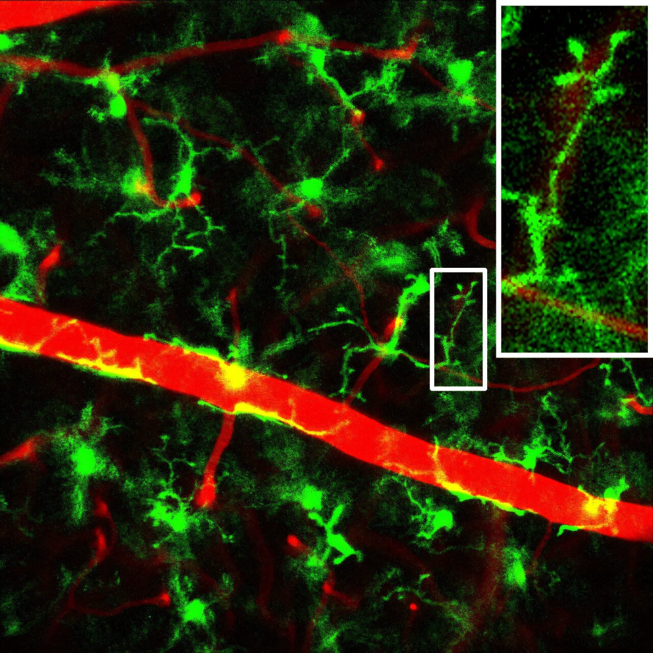 A imagem da retina viva em camundongos revela a atividade das células imunes precoces antes que ocorram danos relacionados ao diabetes