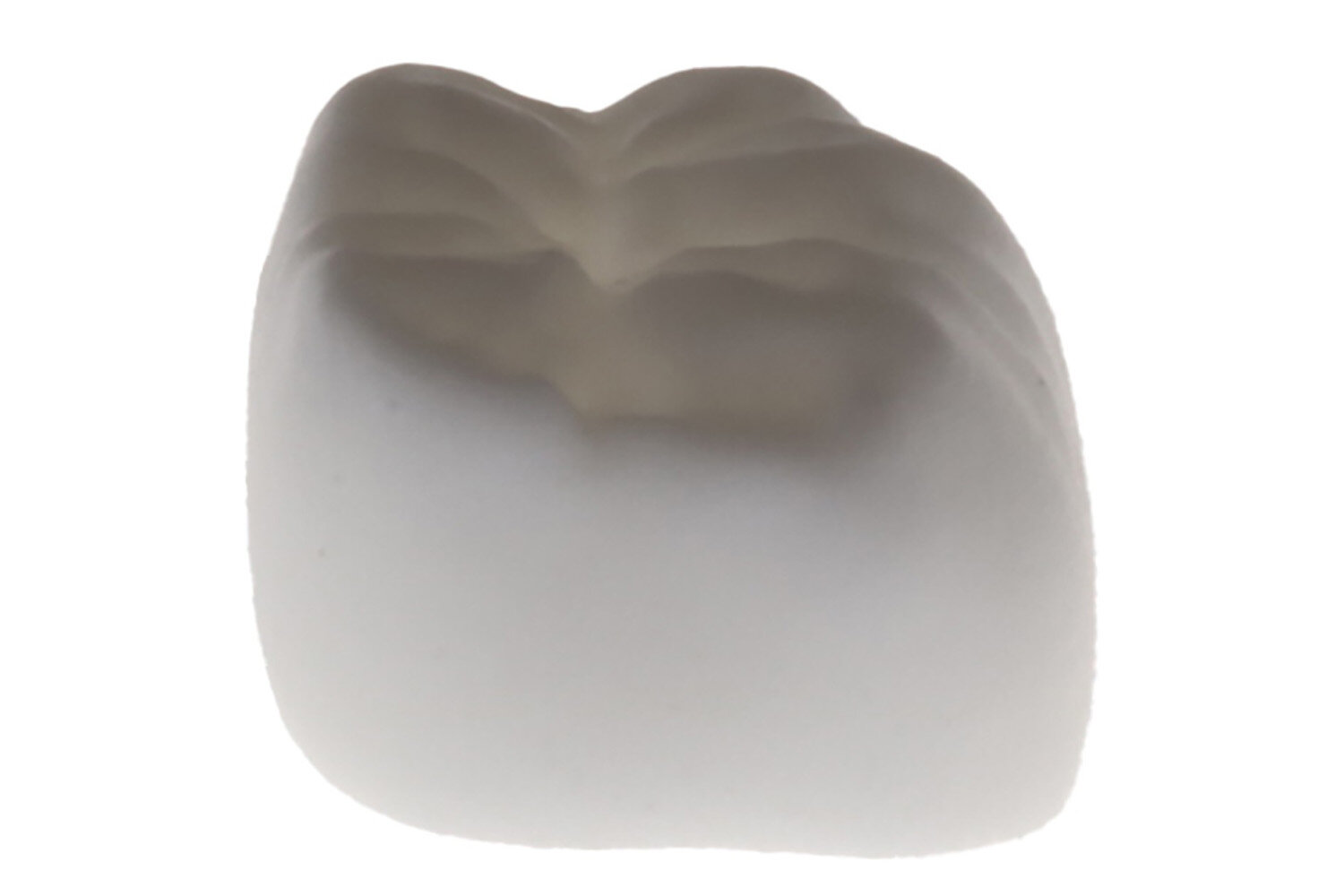 A joia da coroa da tecnologia de restauração dentária pode estar à vista com a impressão 3D