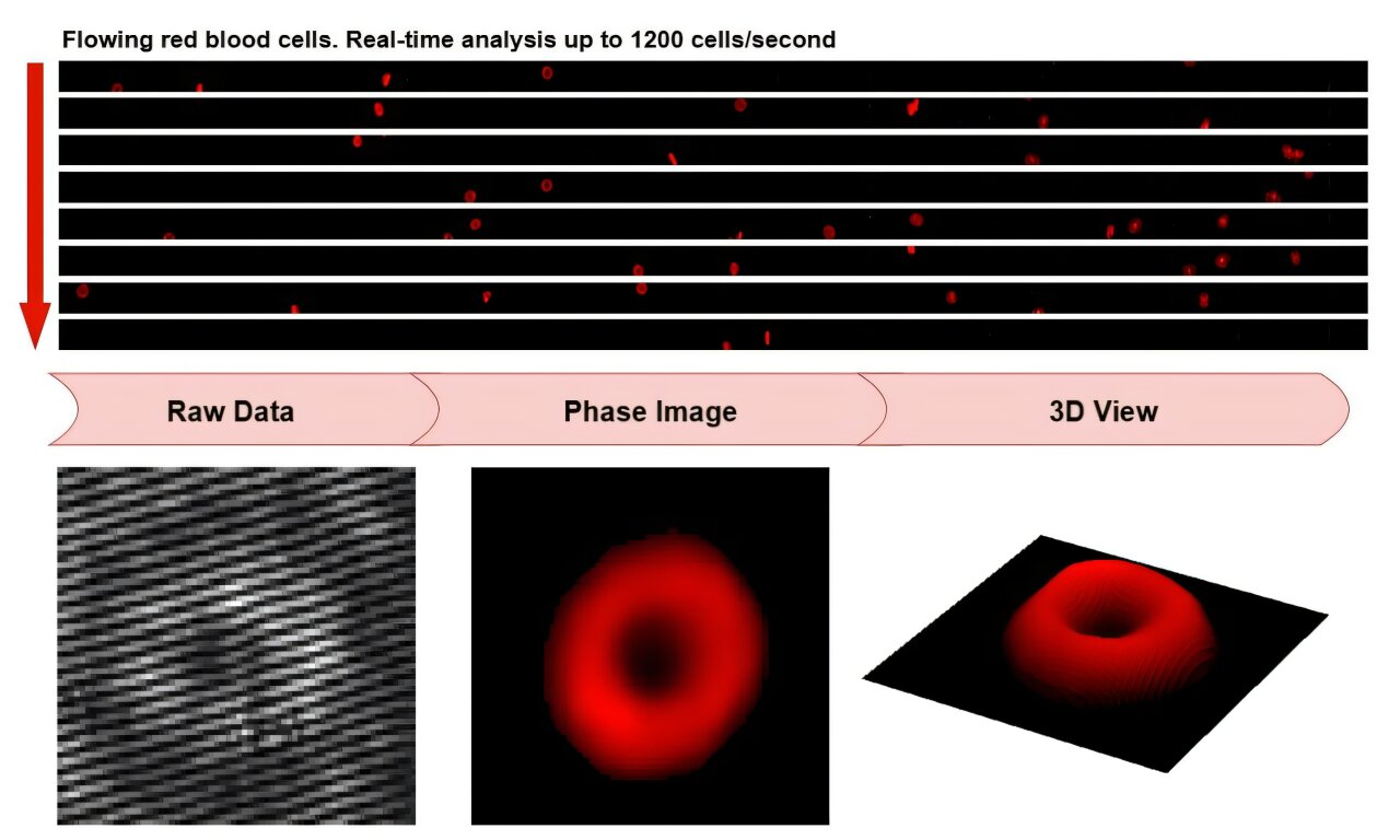 A plataforma GPU incorporada permite imagens e análises de células sanguíneas em tempo real