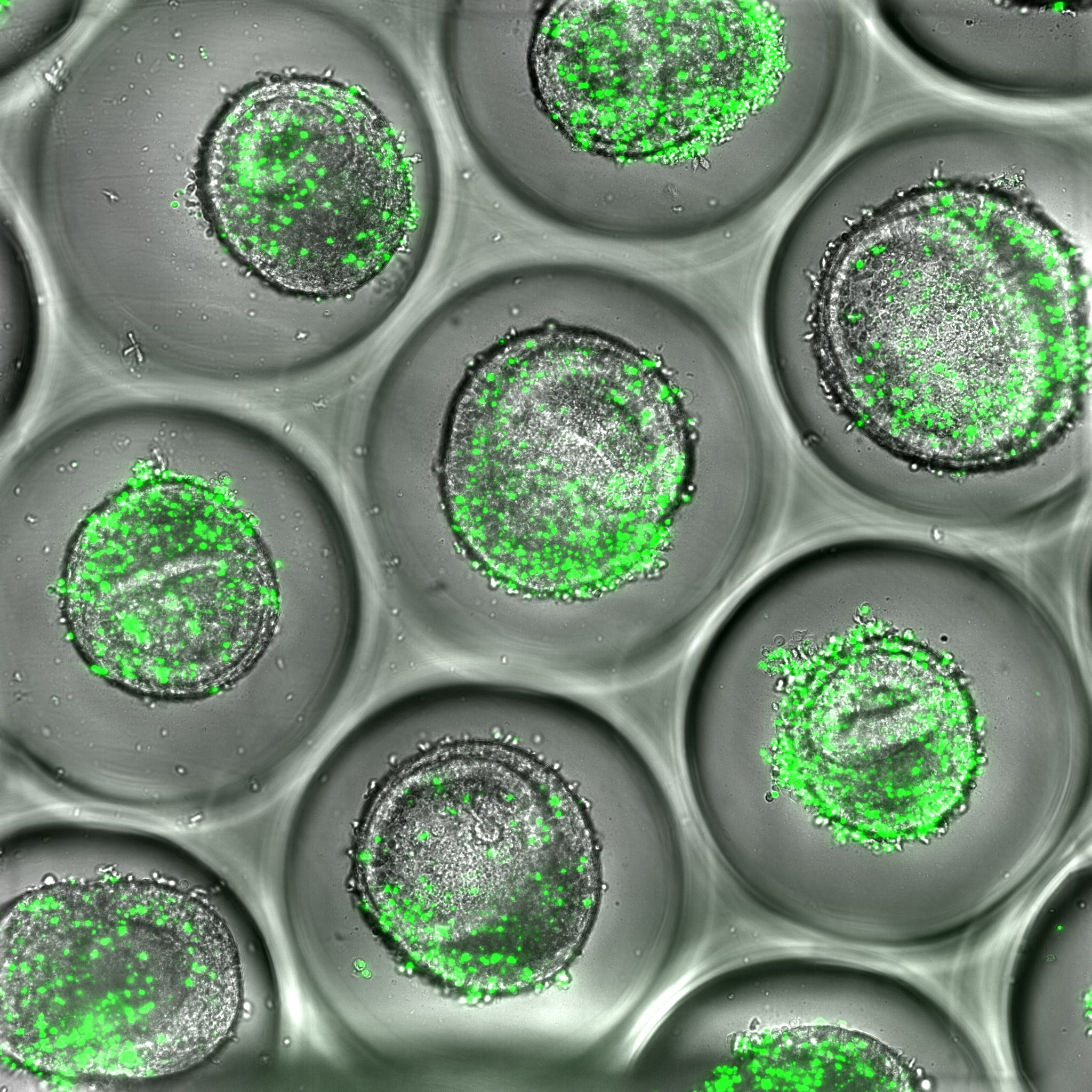 A plataforma organoide do fígado humano pode prever a toxicidade de medicamentos imunomediada