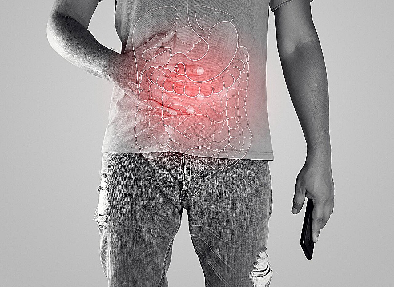 Alterações na microbiota intestinal associadas a resultados de qualidade de vida relacionados à saúde na DII