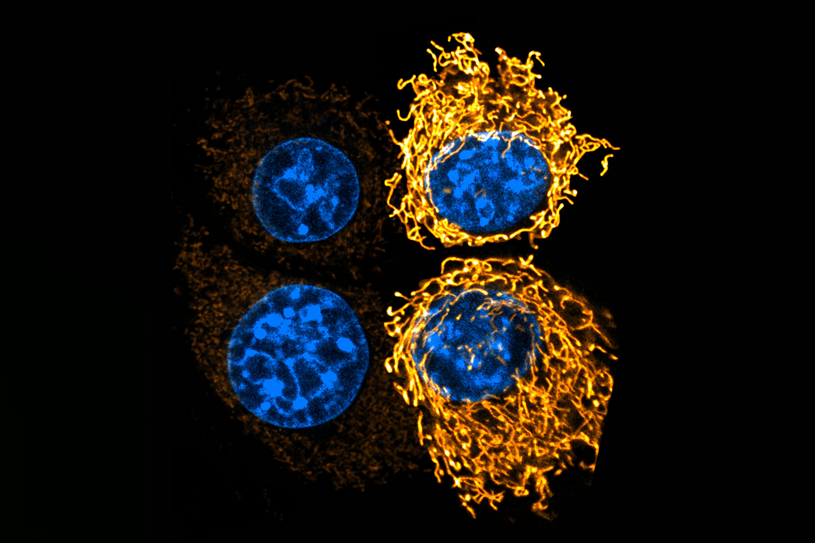 Ambiente tumoral ácido promove sobrevivência e crescimento de células cancerígenas pancreáticas, mostra estudo