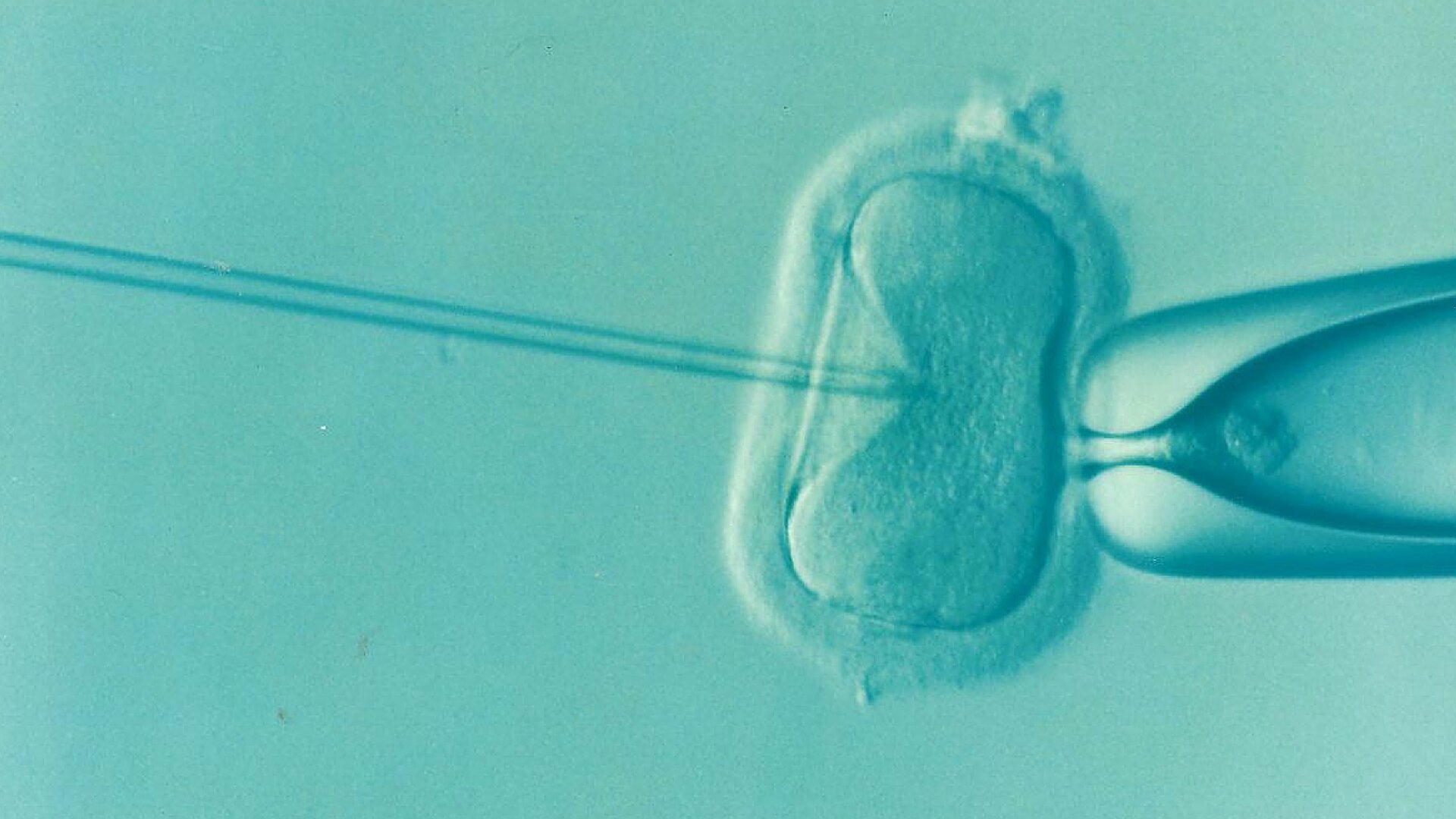 Aqui está o que a revisão da indústria de fertilização in vitro disse que deveria mudar - e o que perdeu