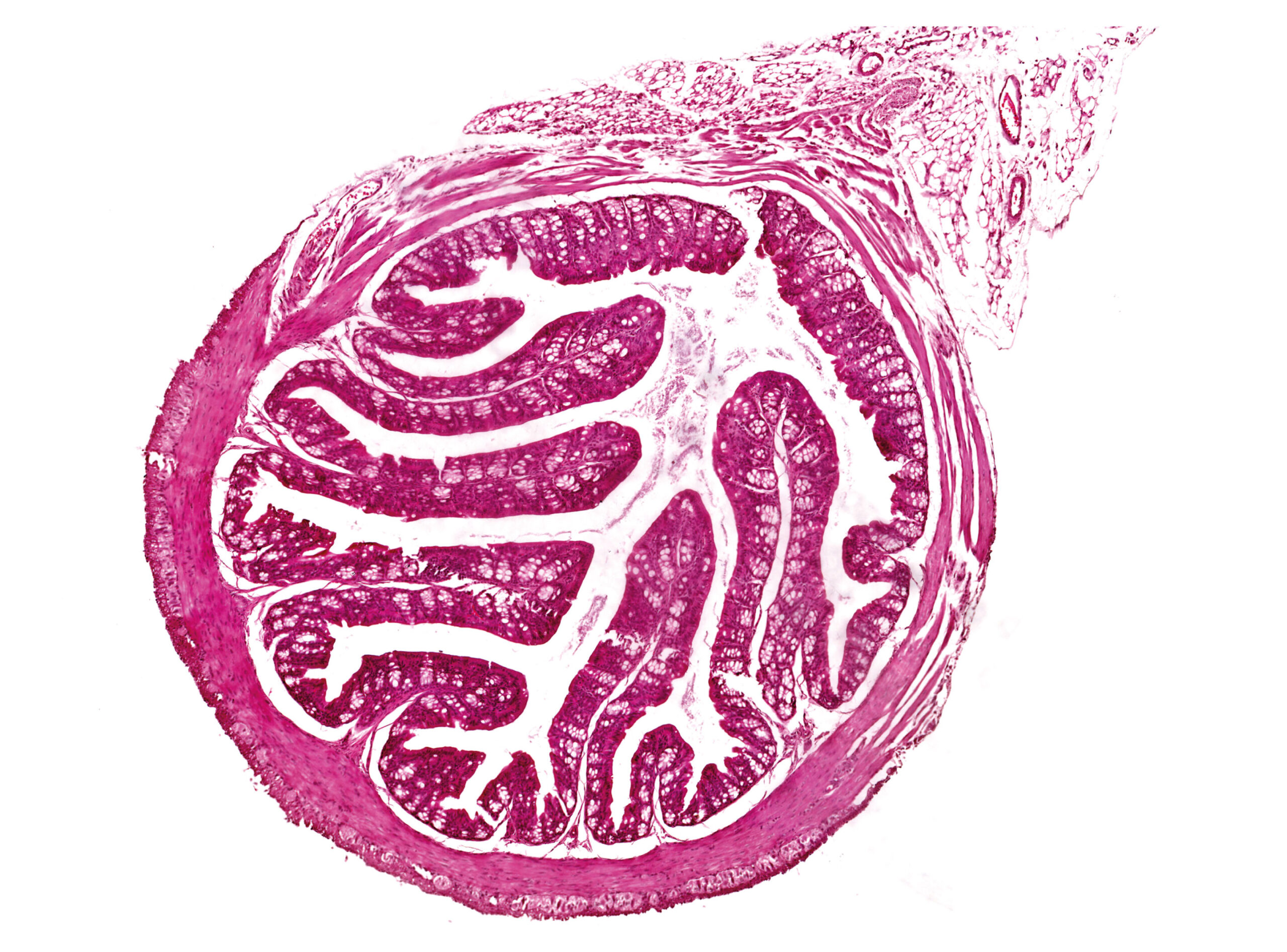 Bactérias intestinais 'boas' podem aumentar a placenta para a gravidez mais saudável