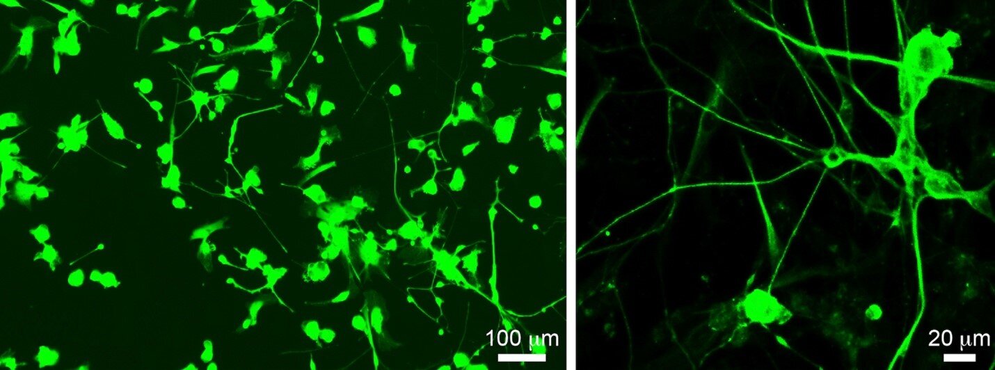 Bioinformática revela terapia regenerativa para lesão medular