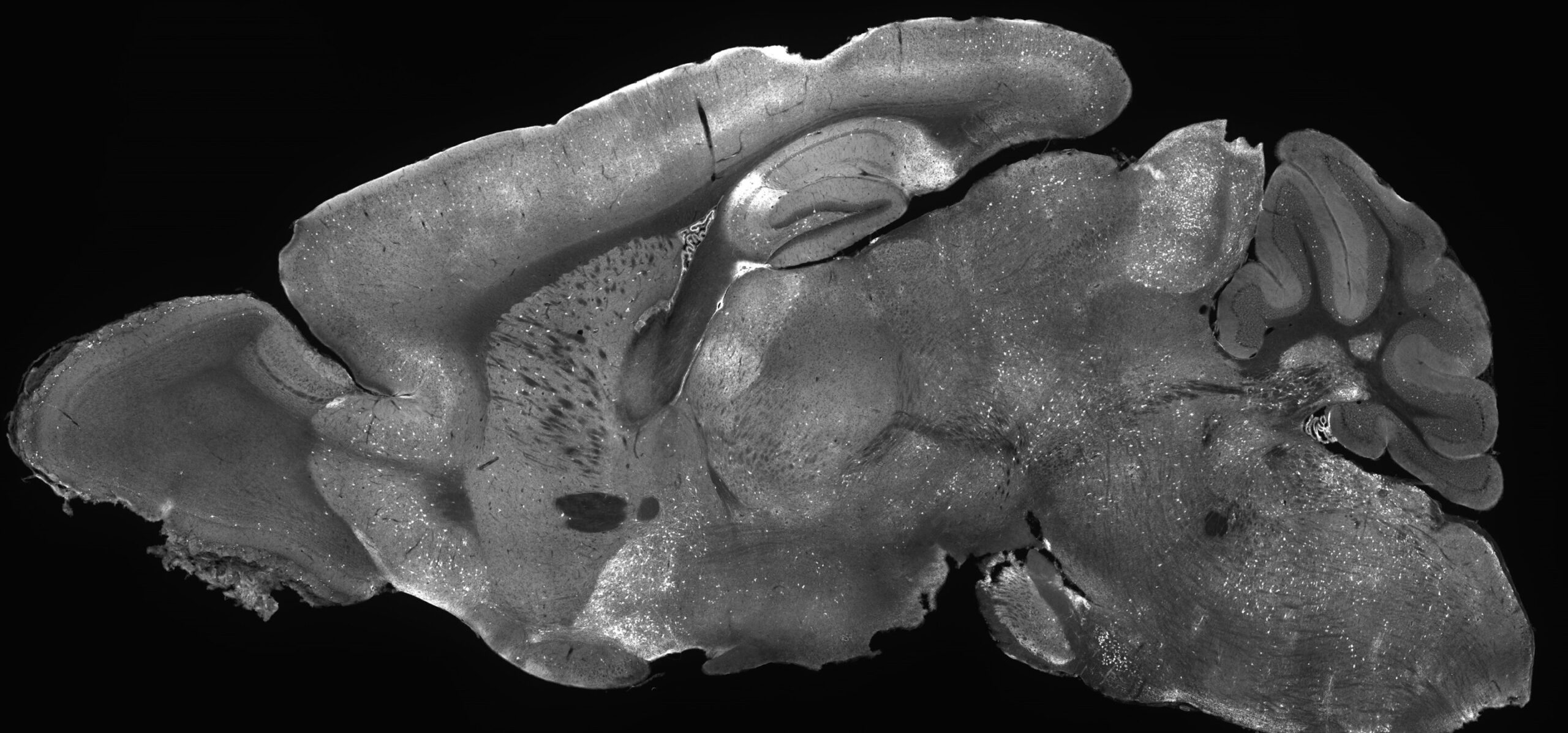 Cientistas corrigem defeito genético em ratos ligados a distúrbios cerebrais que incluem autismo e epilepsia