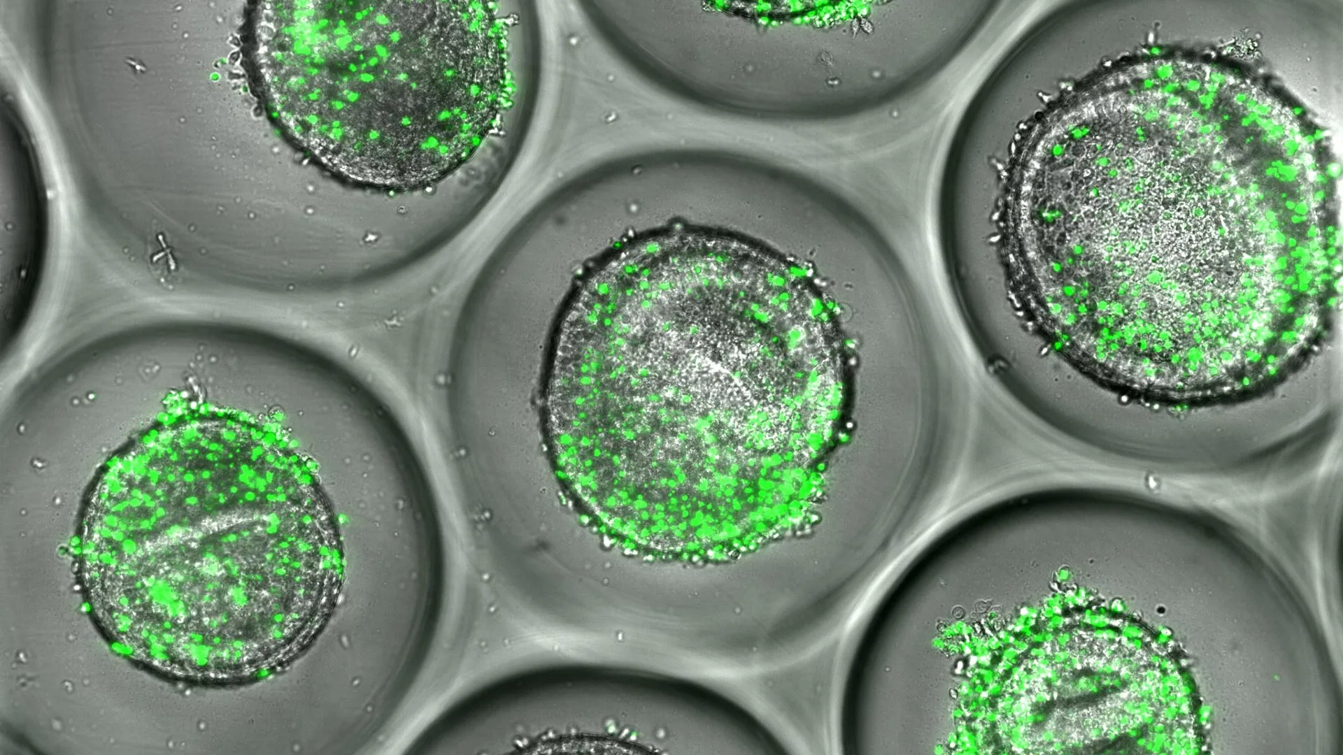 Cientistas cultivam mini fígados humanos que preveem reações tóxicas a medicamentos