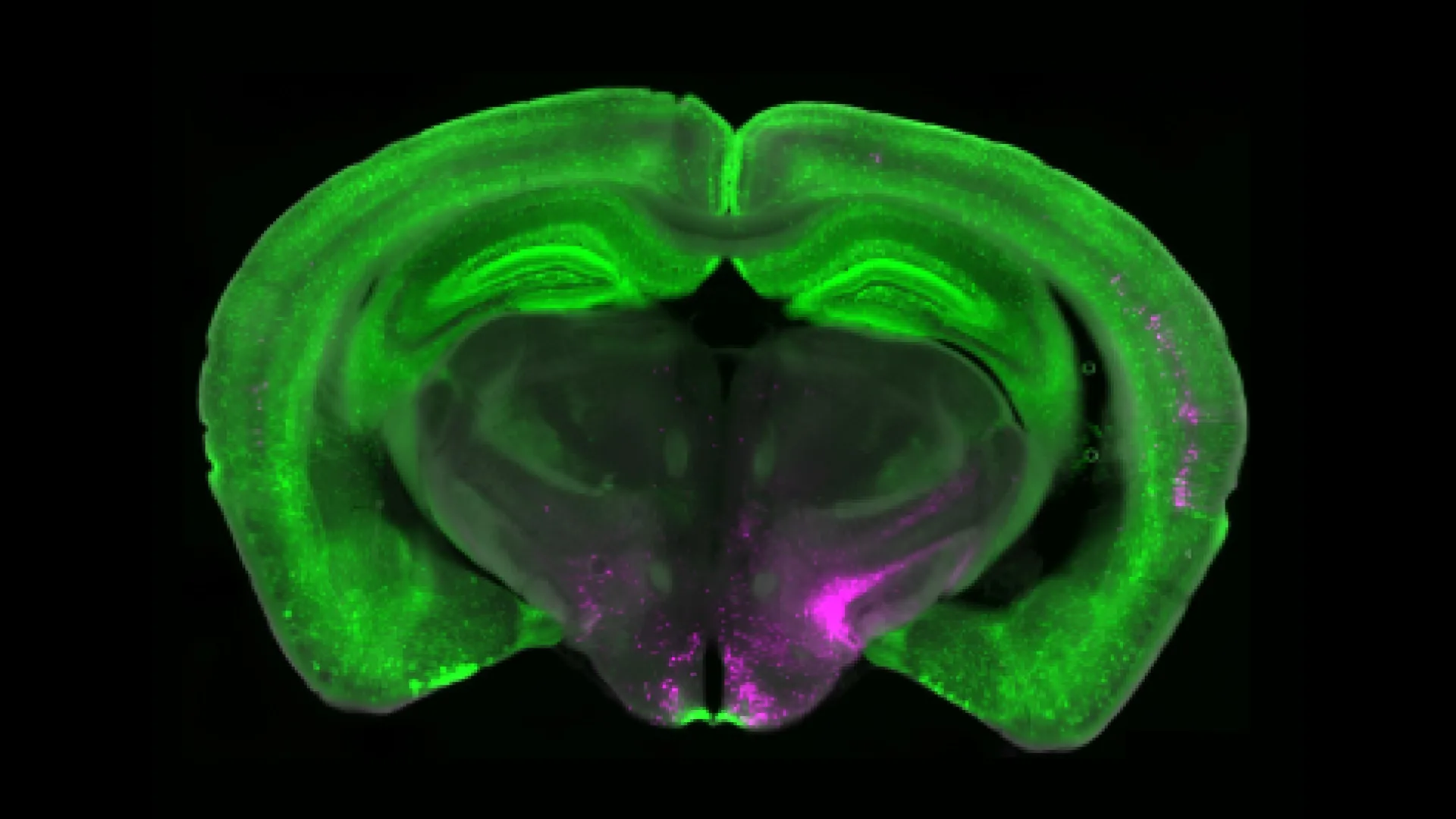 Cientistas descobrem circuito cerebral que pode desligar a dor crônica