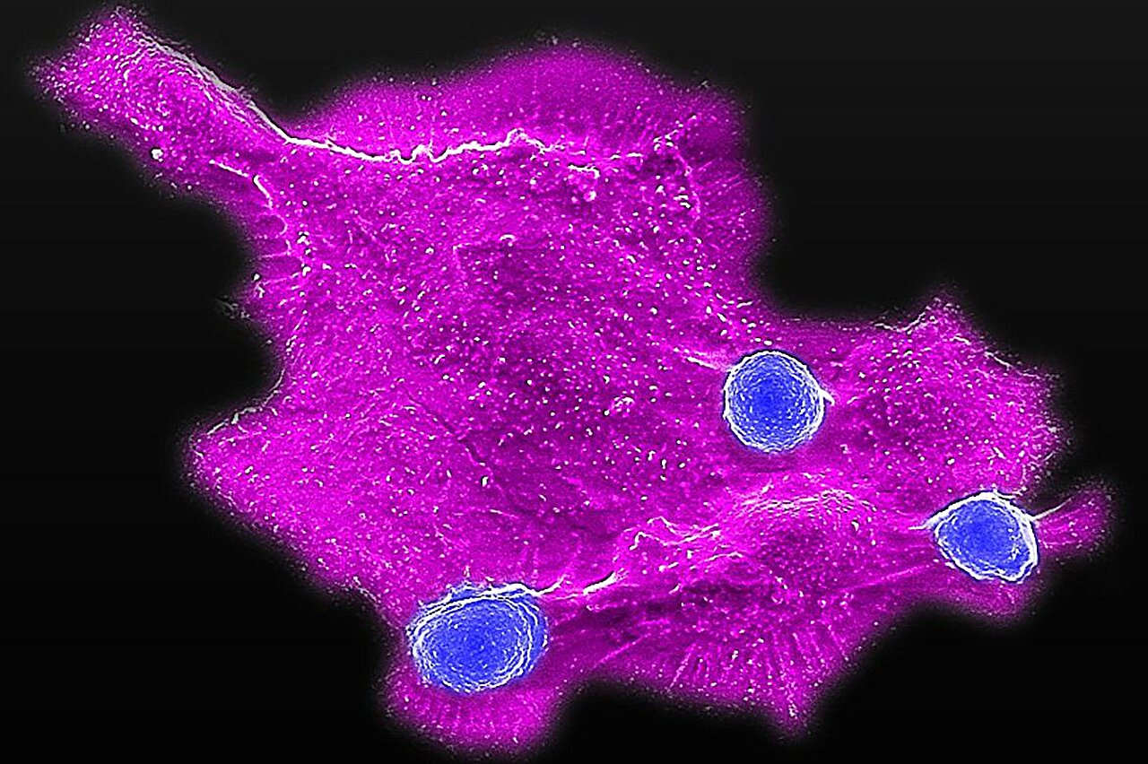 Cientistas desenvolvem imunoterapia única para câncer de mama