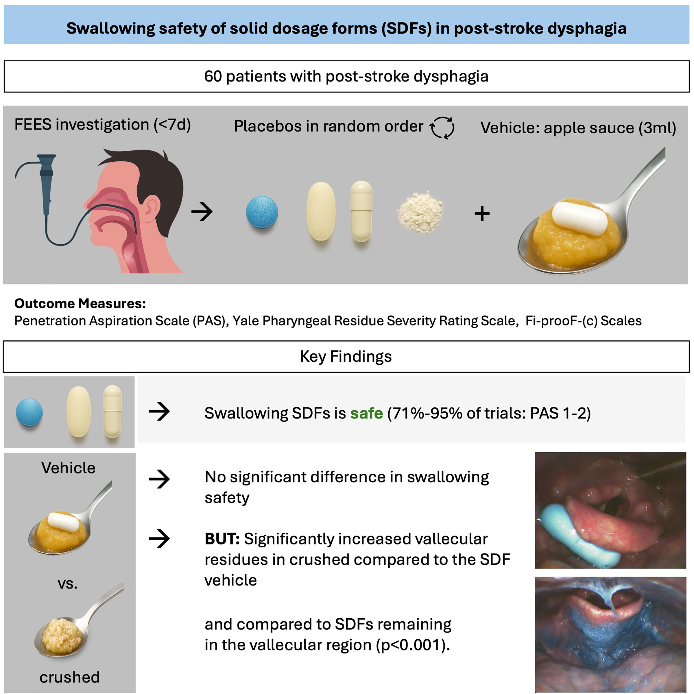Comprimidos inteiros podem ser mais seguros do que triturados para pacientes com distúrbios de deglutição pós-AVC
