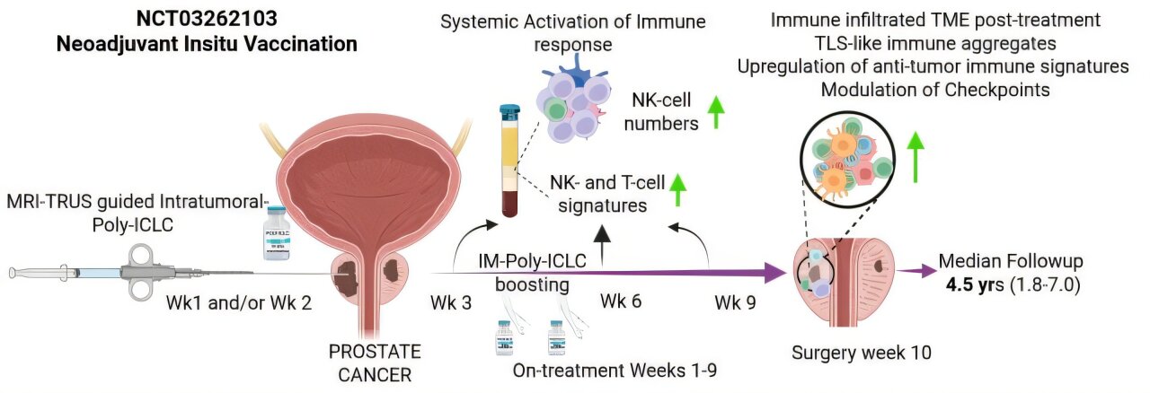 Ensaio clínico inicial testa terapia de reforço imunológico antes da cirurgia de câncer de próstata