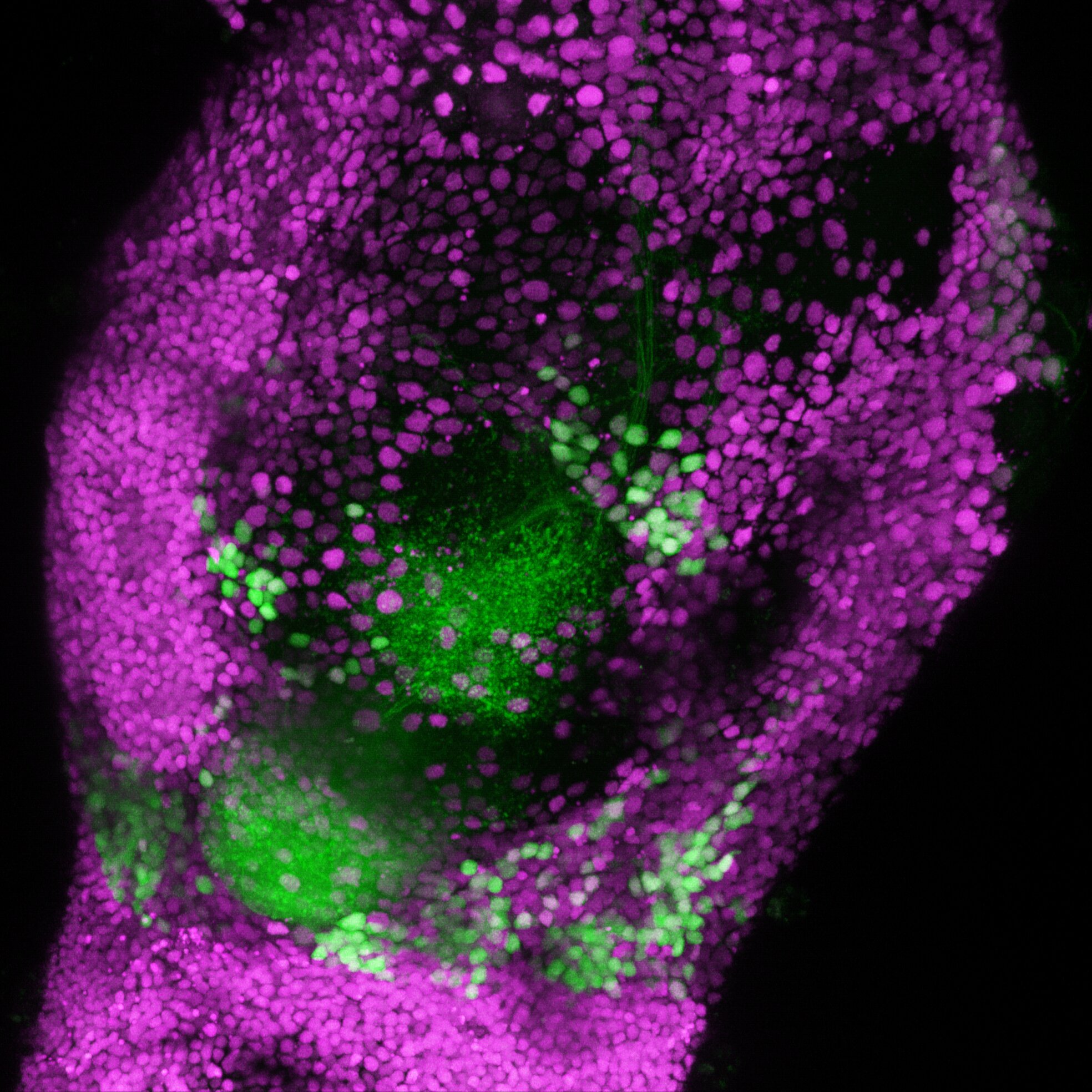 Estudo da mosca frutada revela circuitos neurais para sentir o prazer ou o desagrado dos odores