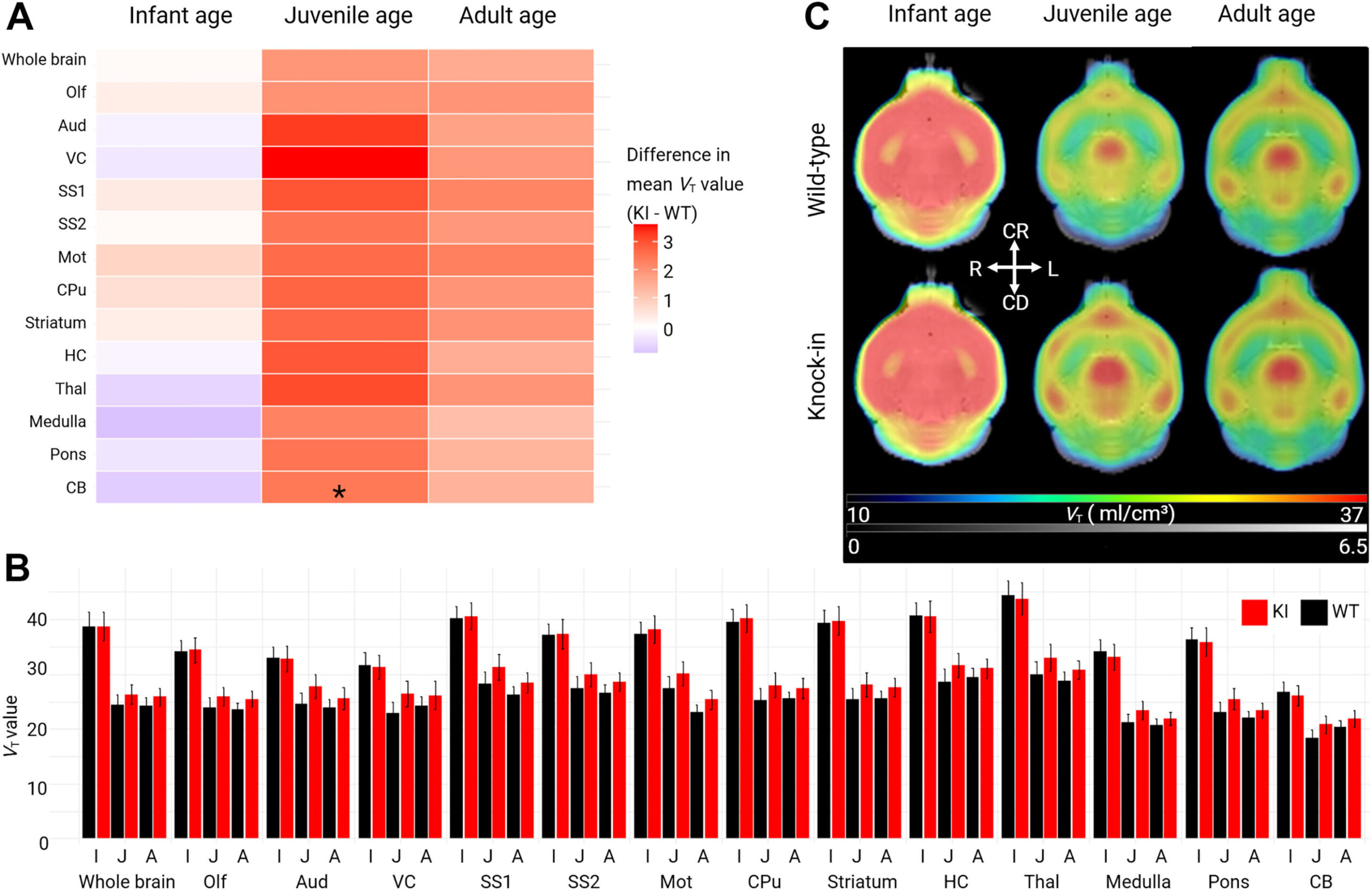 Estudo de imagem mostra como o cérebro se desvia em distúrbios infantis raros