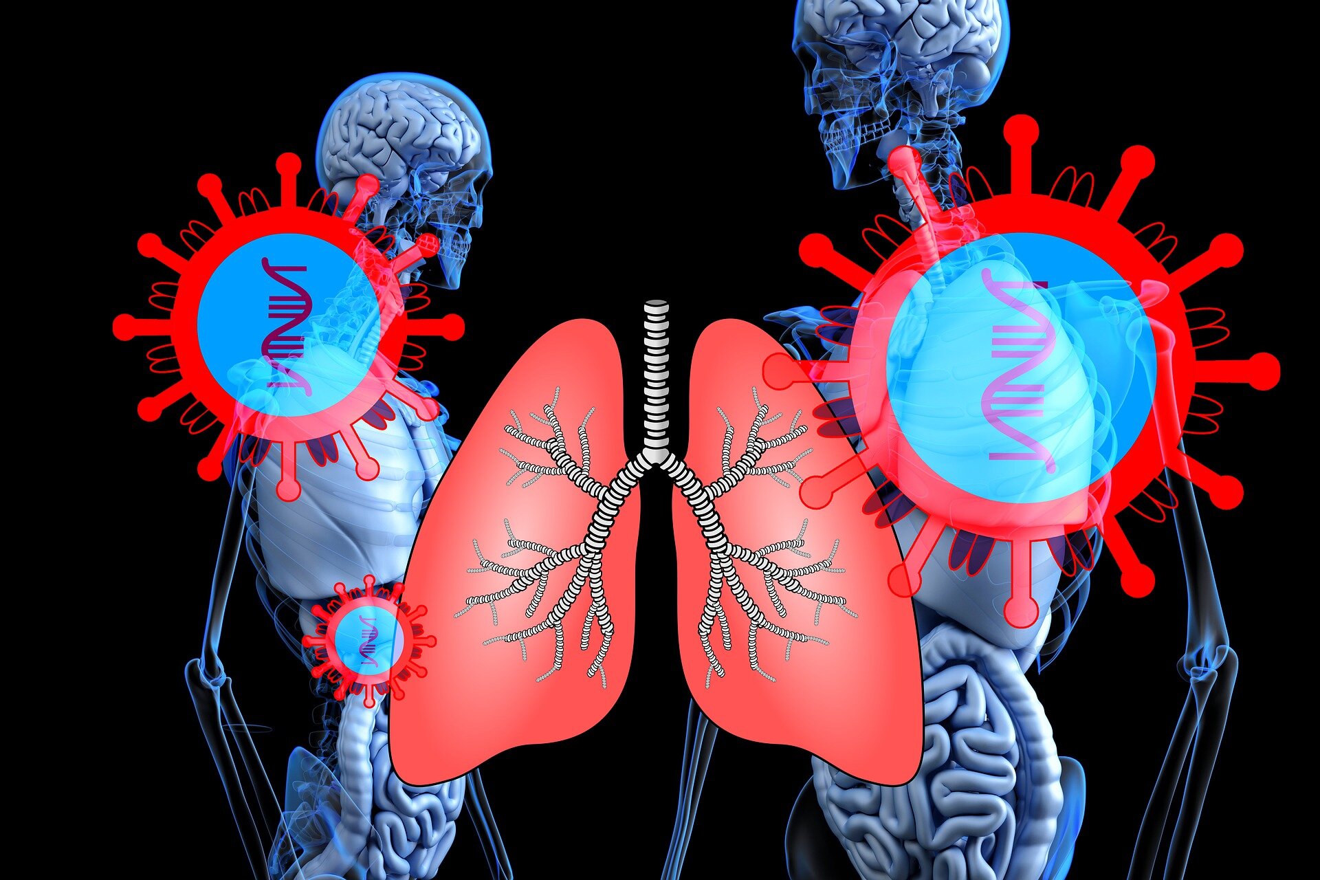 Estudo revela como uma infecção pulmonar teimosa evolui dentro dos pacientes ao longo dos anos