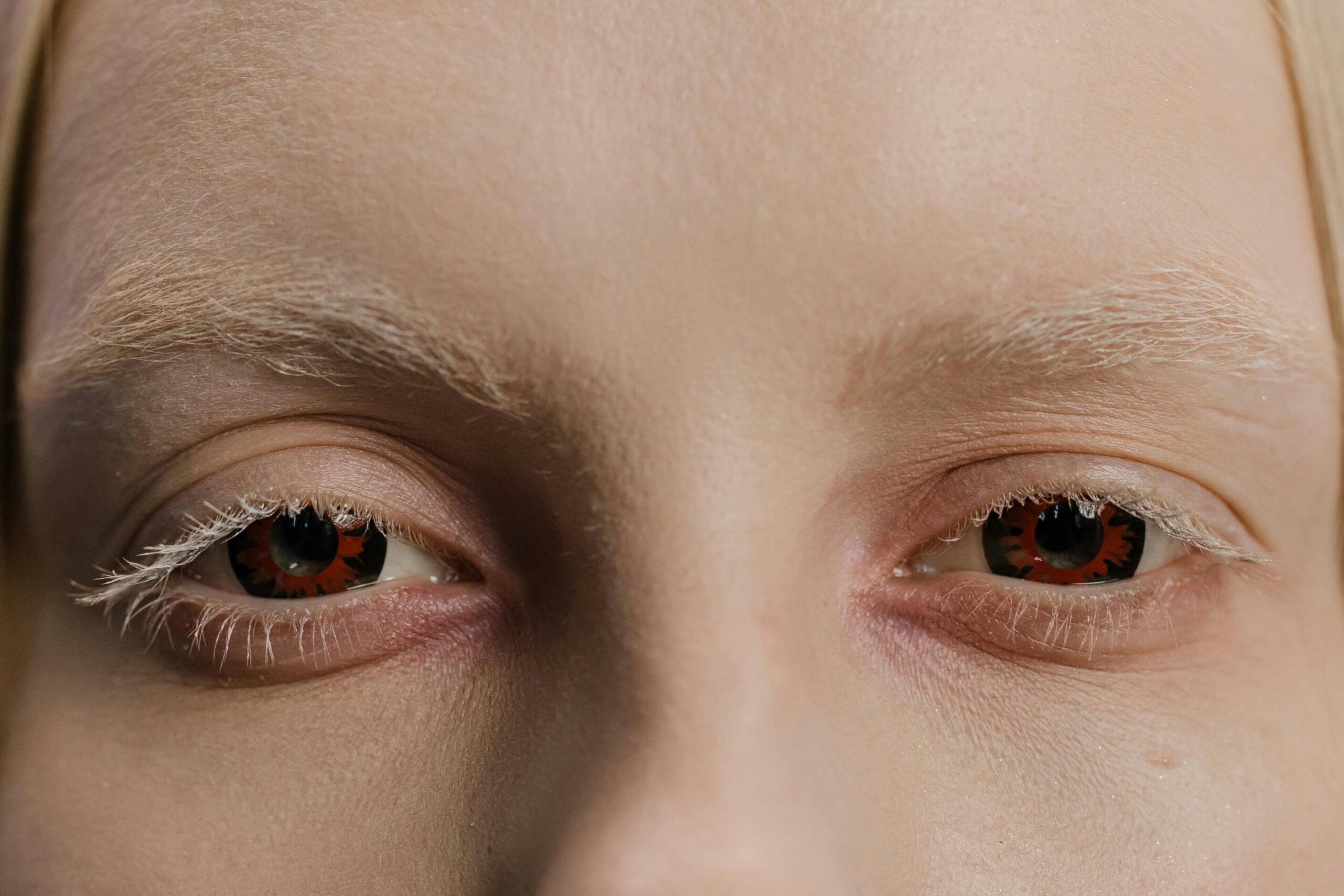 Lentes de contato fantasiadas podem causar infecções, úlceras e até cegueira – como manter seus olhos protegidos neste Halloween