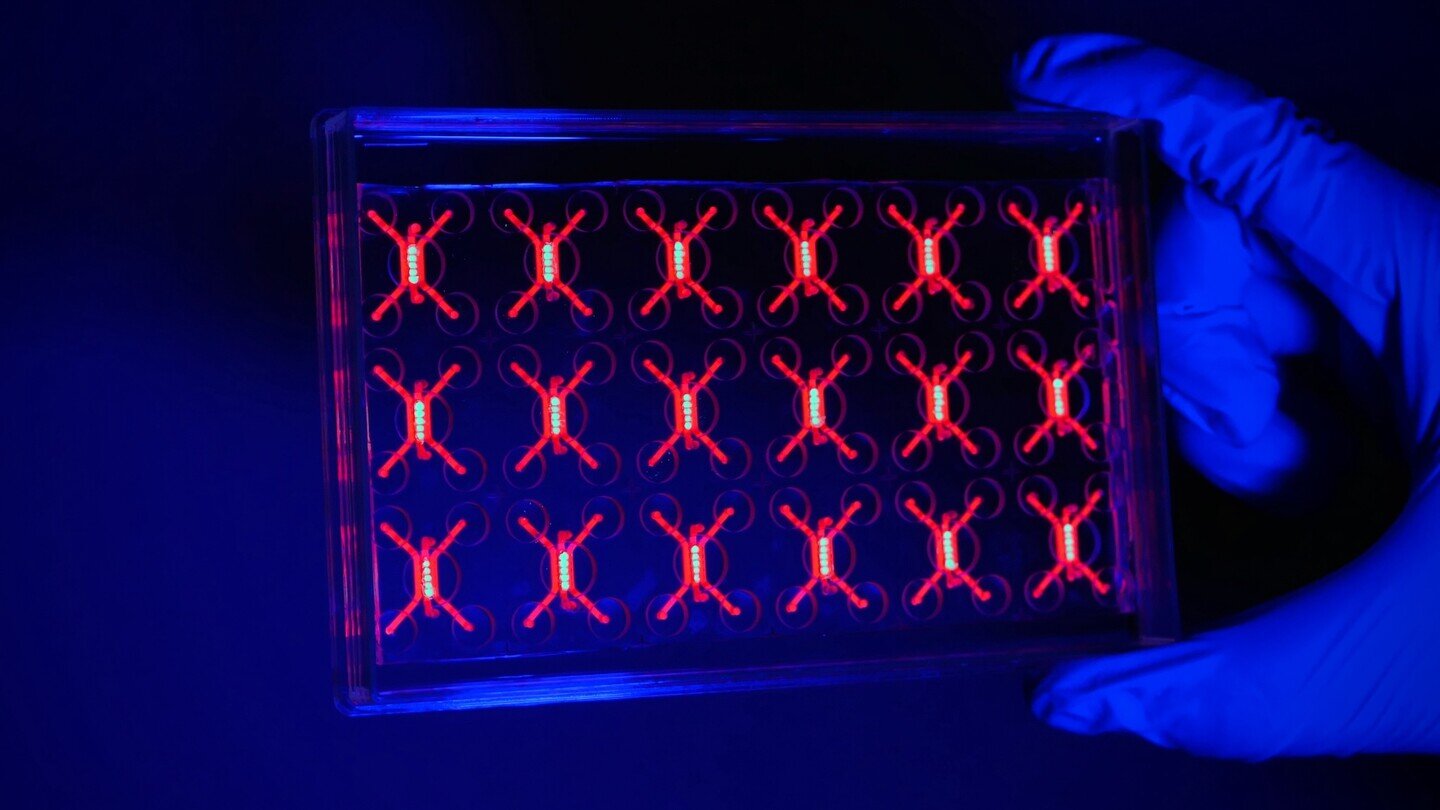 Living tumor-on-a-chip expõe como o câncer bloqueia ataques imunológicos