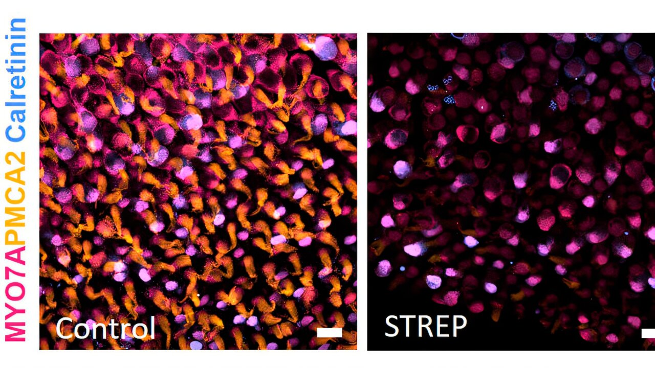 Mecanismos genéticos revelam como as substâncias tóxicas danificam as células do equilíbrio do ouvido interno