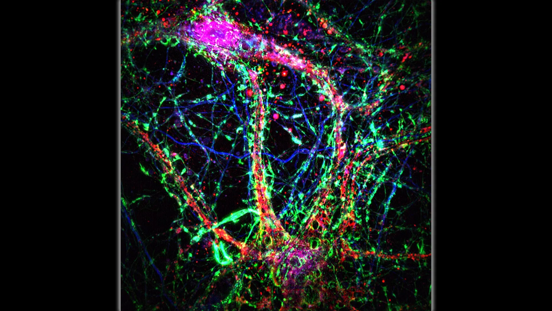Minúsculos nanotubos cerebrais encontrados pela Johns Hopkins podem espalhar a doença de Alzheimer