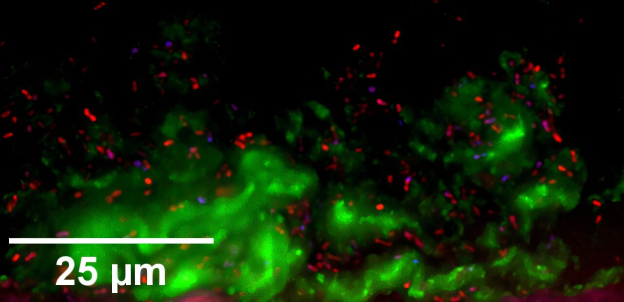 Modelos de nariz em miniatura podem ajudar a prevenir infecções e promover a saúde nasal