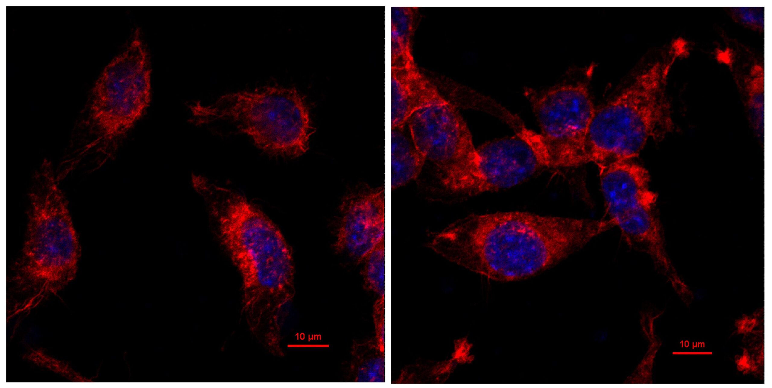 Mutação produz novas pistas para o tratamento de tumores imunes “frios”