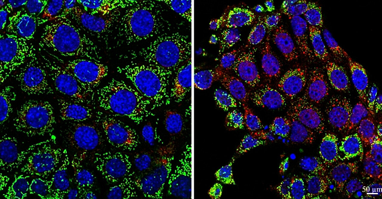 Mutações no DNA mitocondrial causadas por estressores renais podem ajudar a prever o declínio futuro dos órgãos