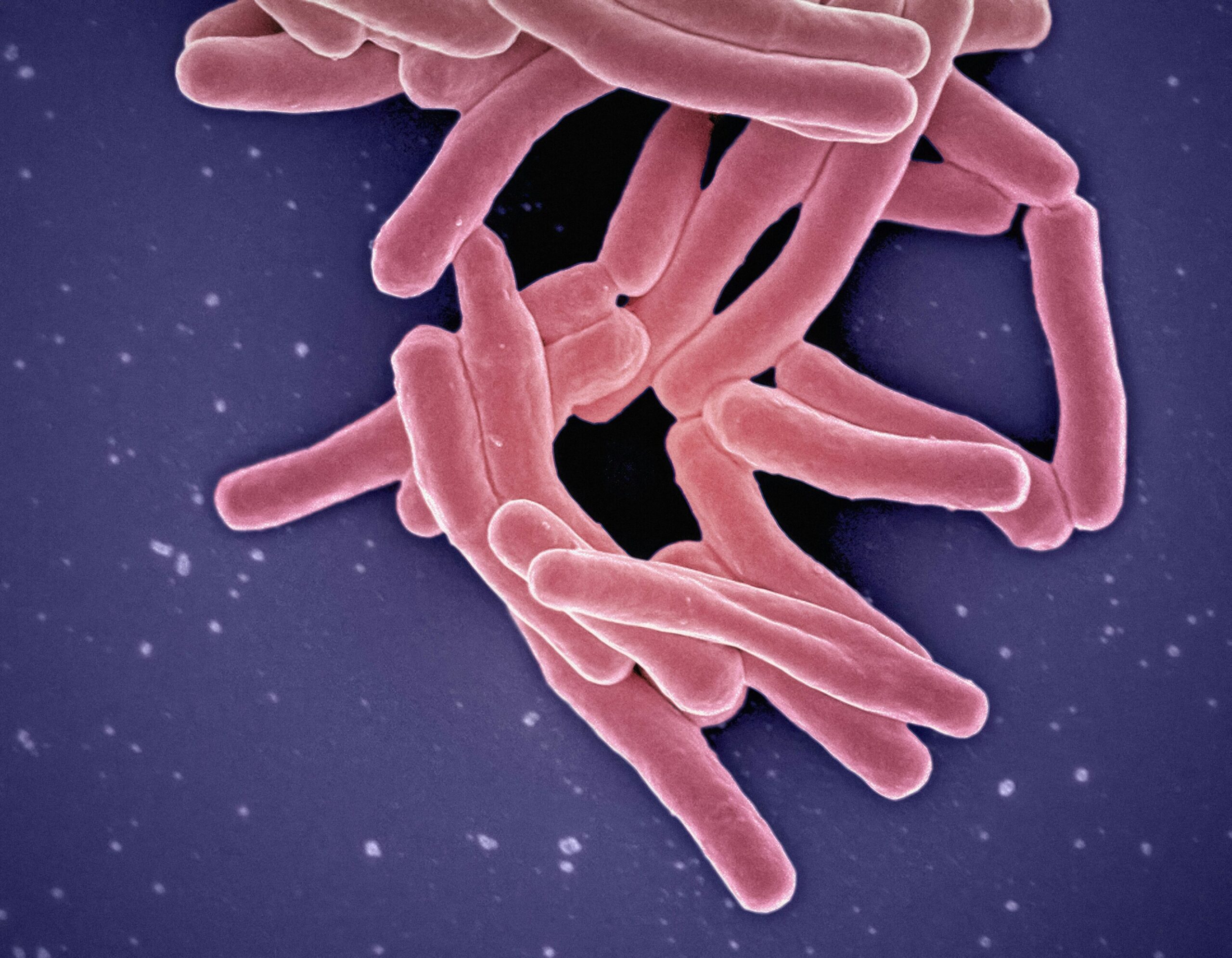 Novo método pode detectar tuberculose infecciosa no ar