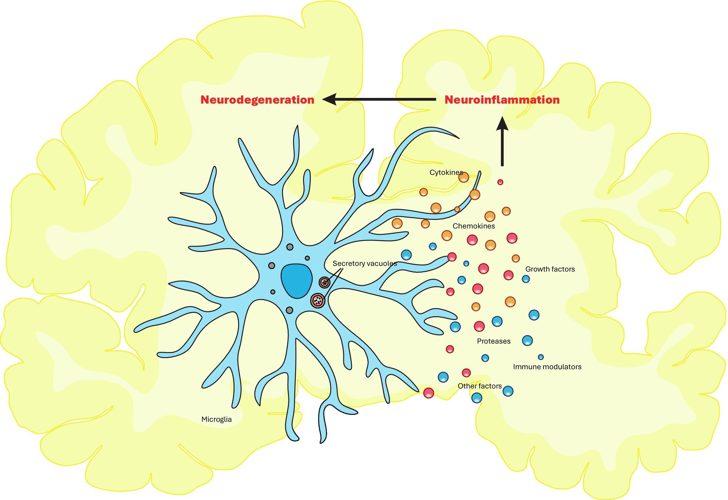 O papel da inflamação cerebral na doença de Alzheimer e na doença de Parkinson pode depender do comportamento da microglia