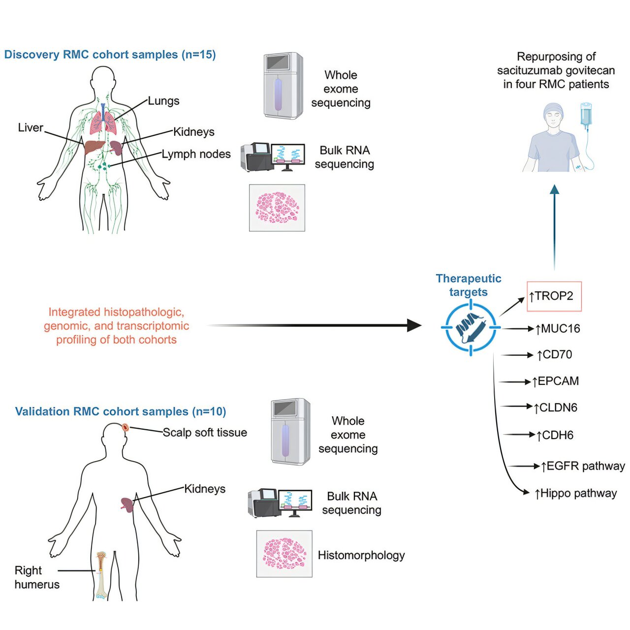 O perfil molecular do carcinoma medular renal identifica o TROP2 como um alvo terapêutico promissor