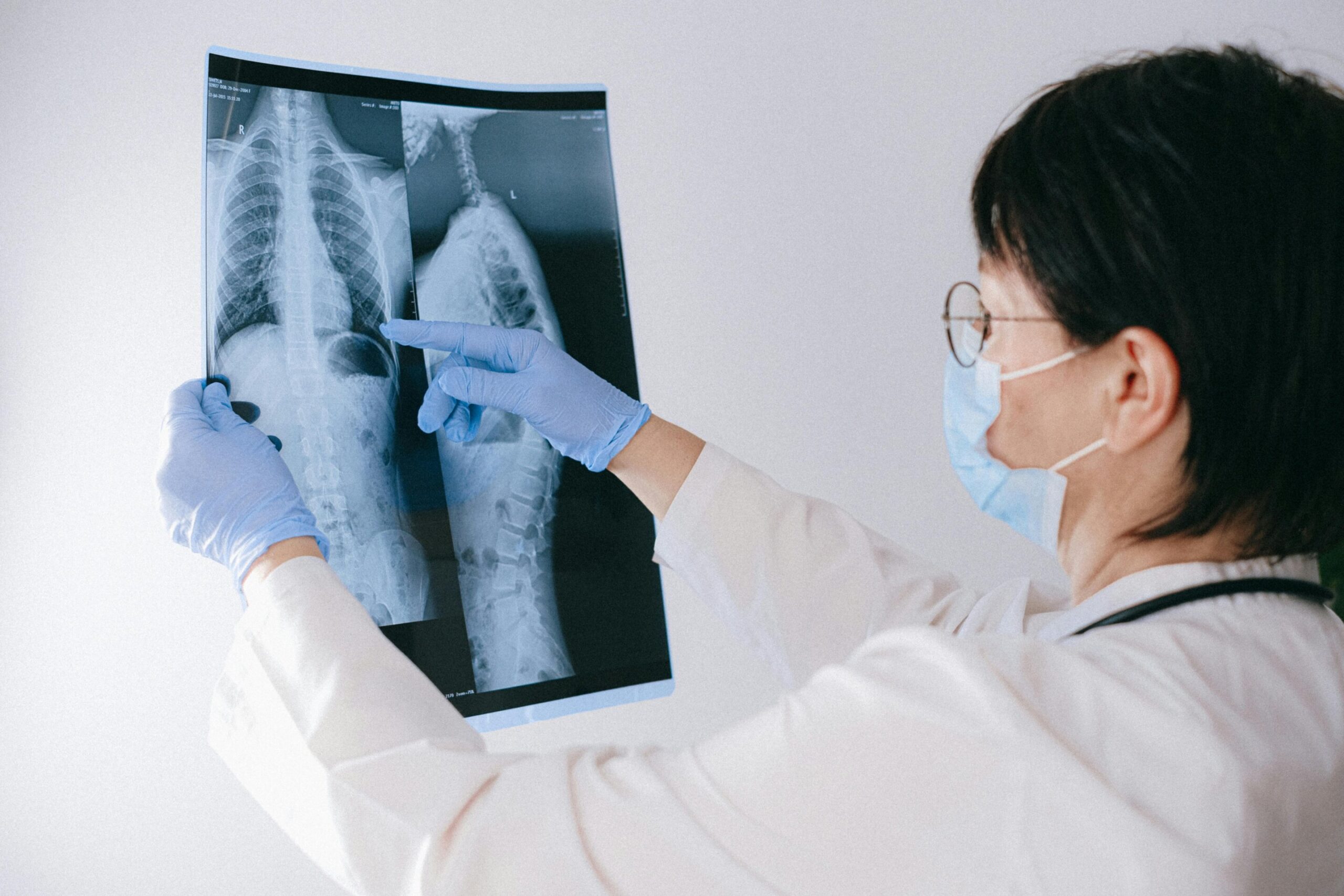 O uso direcionado de esteróides pode oferecer um tratamento complementar universal para combater a TB