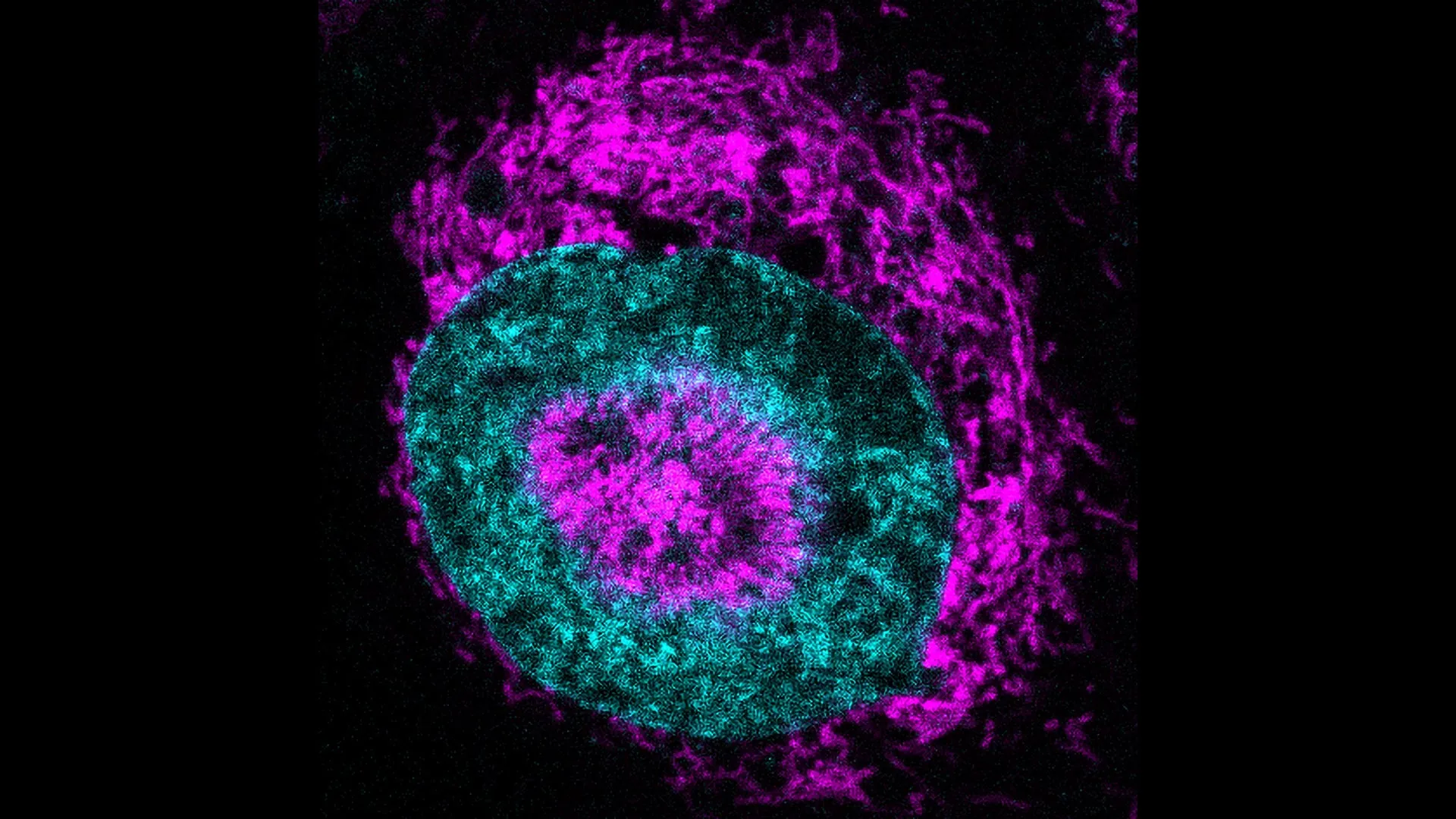 Os cientistas acabaram de encontrar a fonte de energia oculta das células cancerígenas