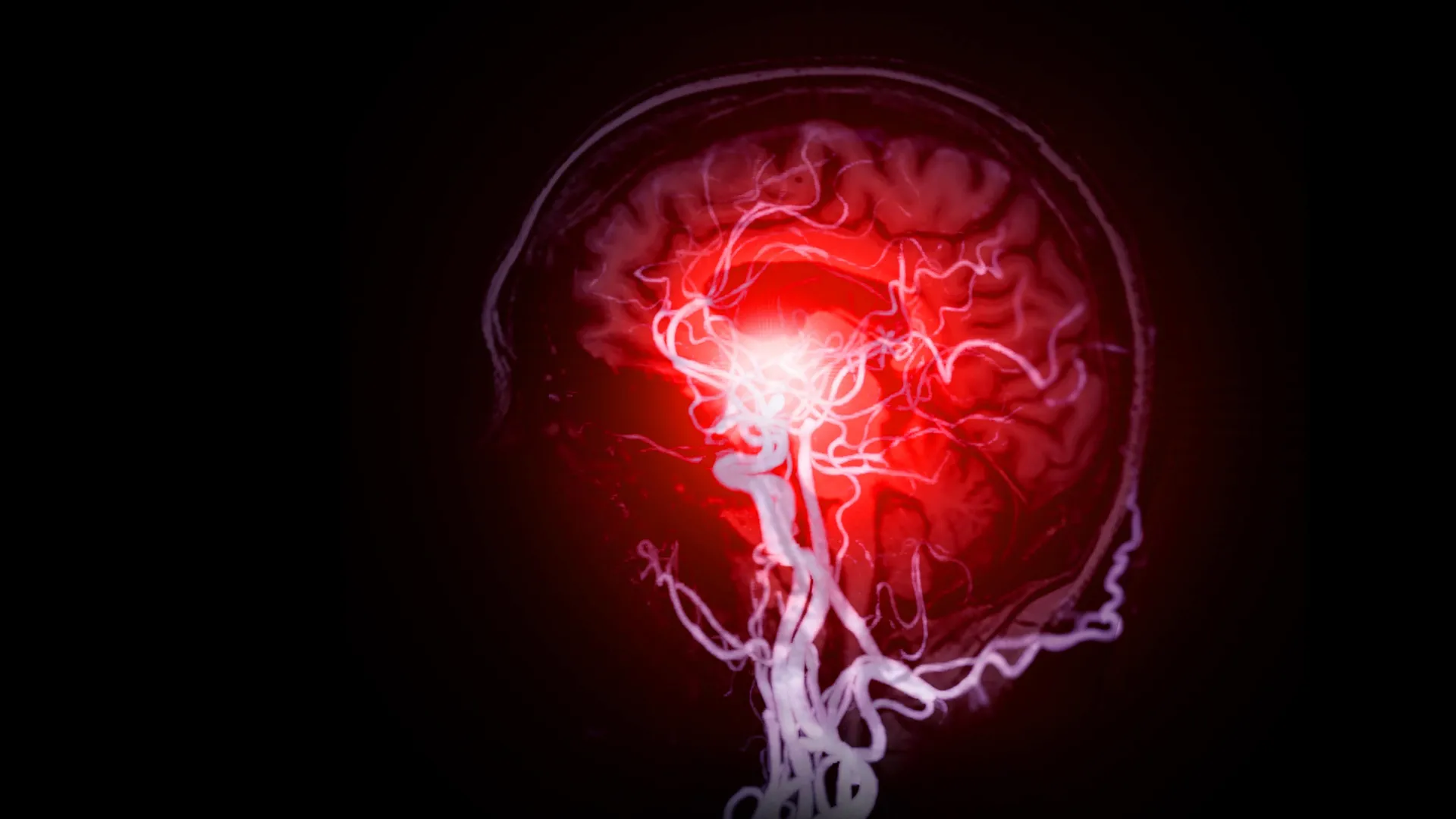 Os cientistas encontram danos cerebrais ocultos por trás da demência