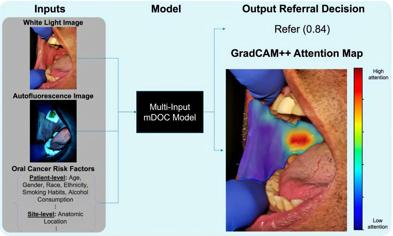 Sistema de imagem de smartphone mostra-se promissor para detecção precoce de câncer bucal em clínicas odontológicas