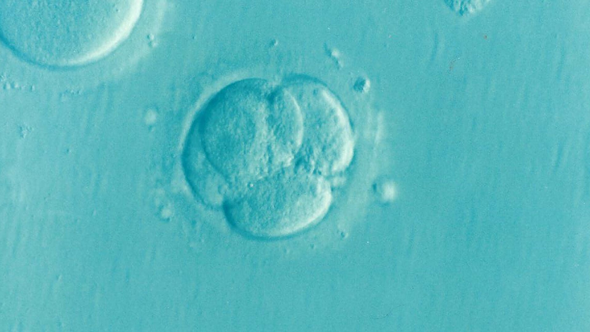 Técnica amplamente utilizada para avaliar embriões de fertilização in vitro pode ser falha, sugere estudo
