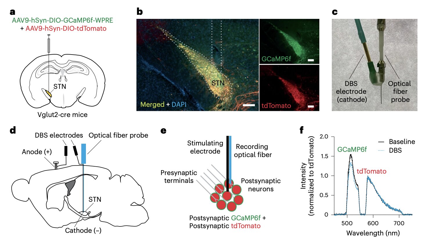 Um mecanismo recentemente descoberto poderia contribuir para os efeitos terapêuticos da estimulação cerebral profunda