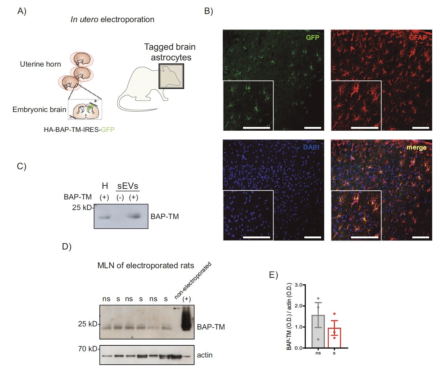 Vesículas derivadas de astrócitos podem ligar o estresse à inflamação intestinal