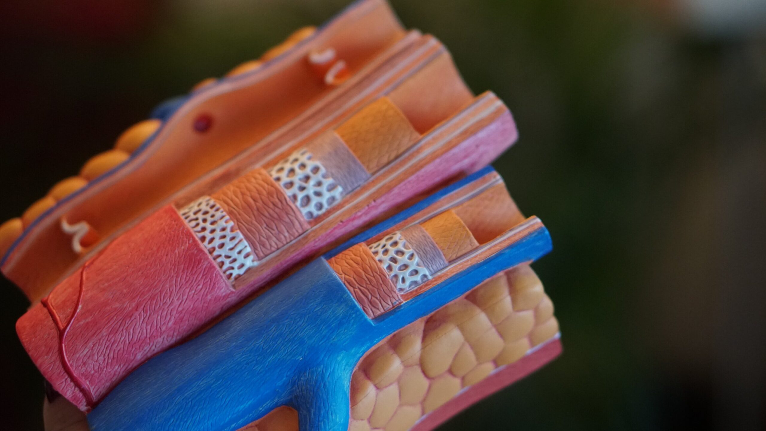 A colocação de stent em todas as artérias bloqueadas supera a abordagem de tratamento apenas do culpado, mostra estudo