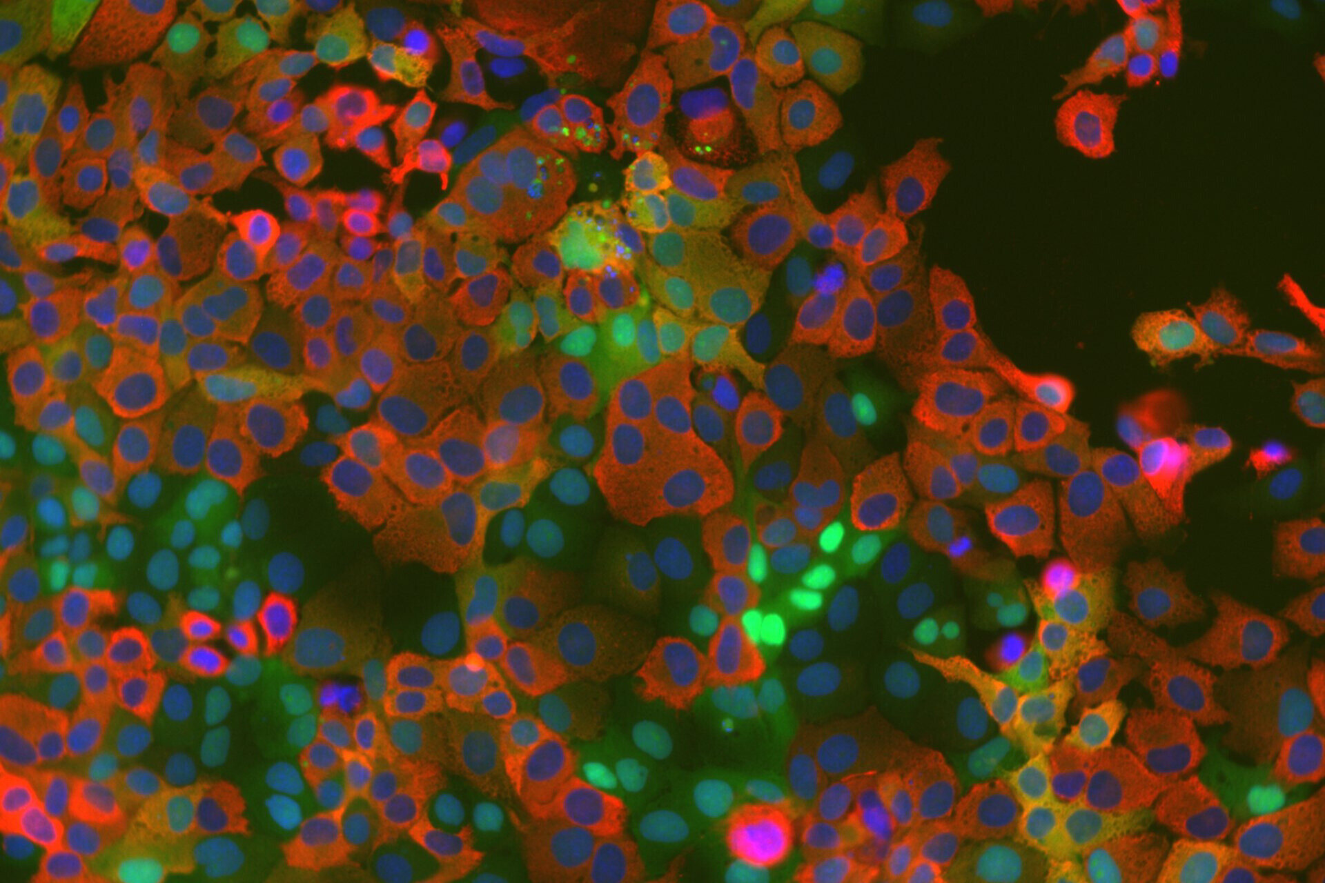 A replicação do coronavírus depende de uma enzima hospedeira recentemente identificada, segundo estudo