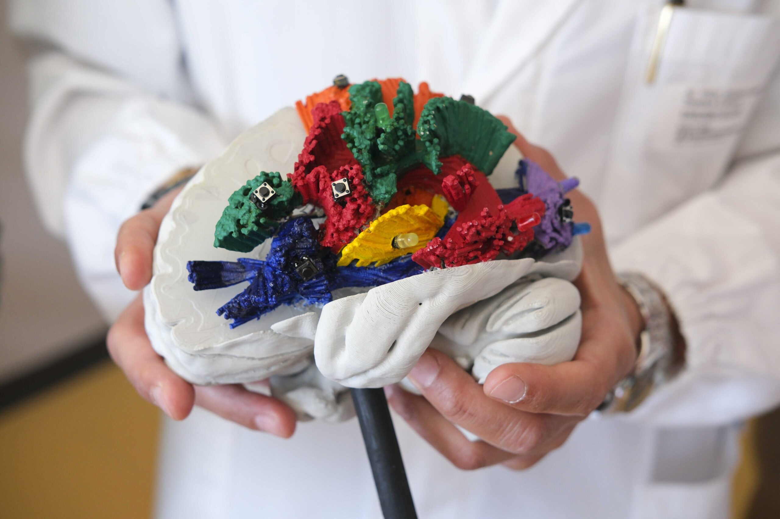 Atlas 3D mescla dissecção cerebral e imagens para mapeamento detalhado da substância branca