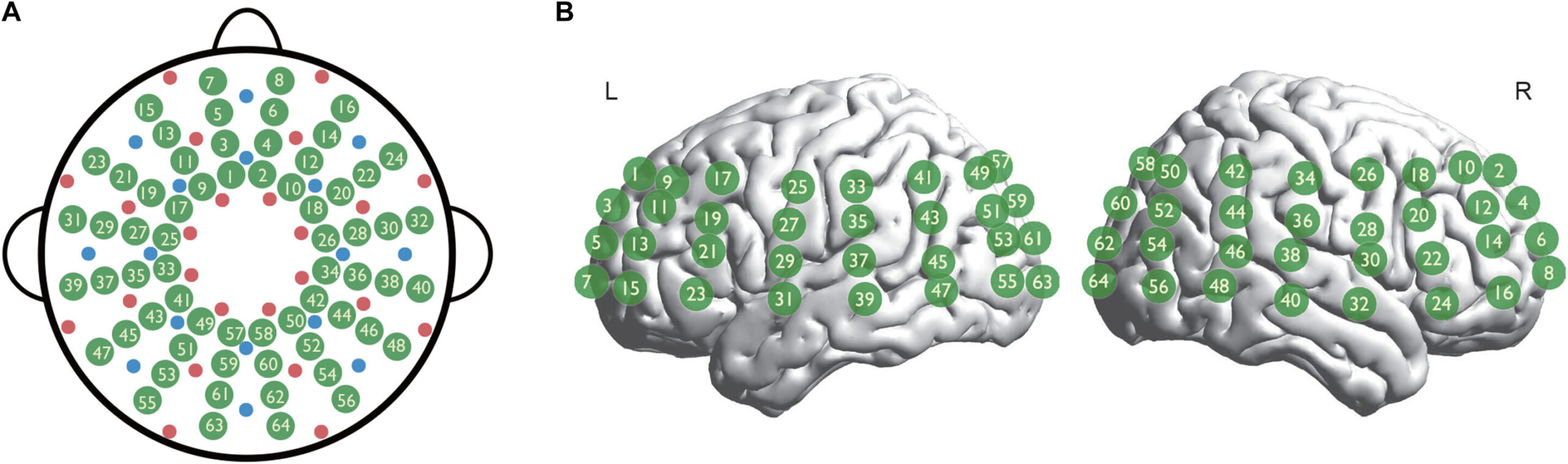 Bebês nascidos com perda auditiva apresentam perturbações no design do cérebro, ressaltando a urgência da intervenção