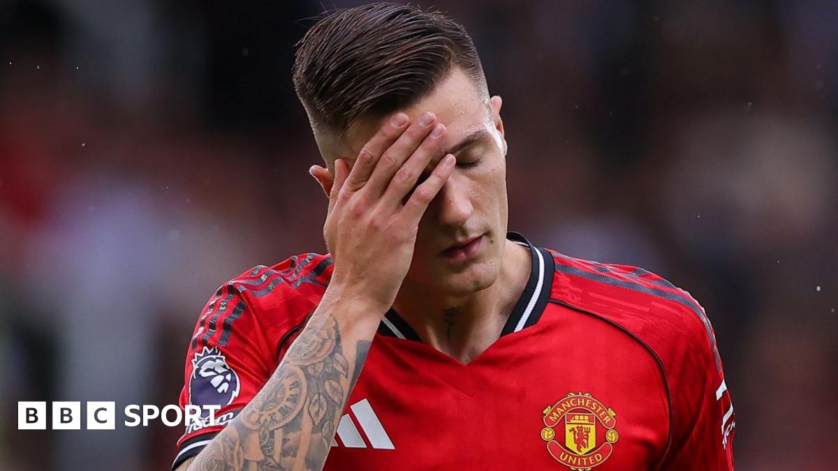 Benjamin Sesko grimaces while playing for Manchester United