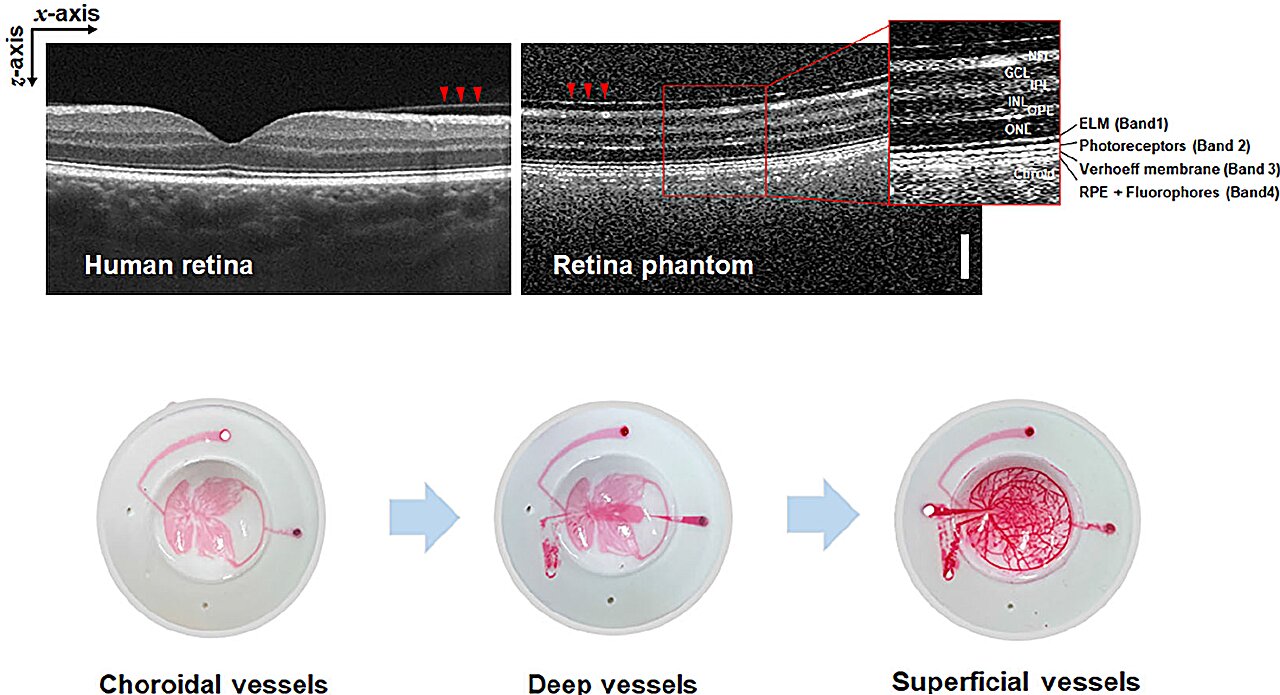 Cientistas criam fantasma de retina artificial para padronizar equipamentos de diagnóstico de doenças oculares