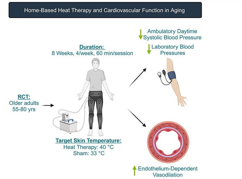Cientistas tentam terapia de calor para reduzir a pressão arterial