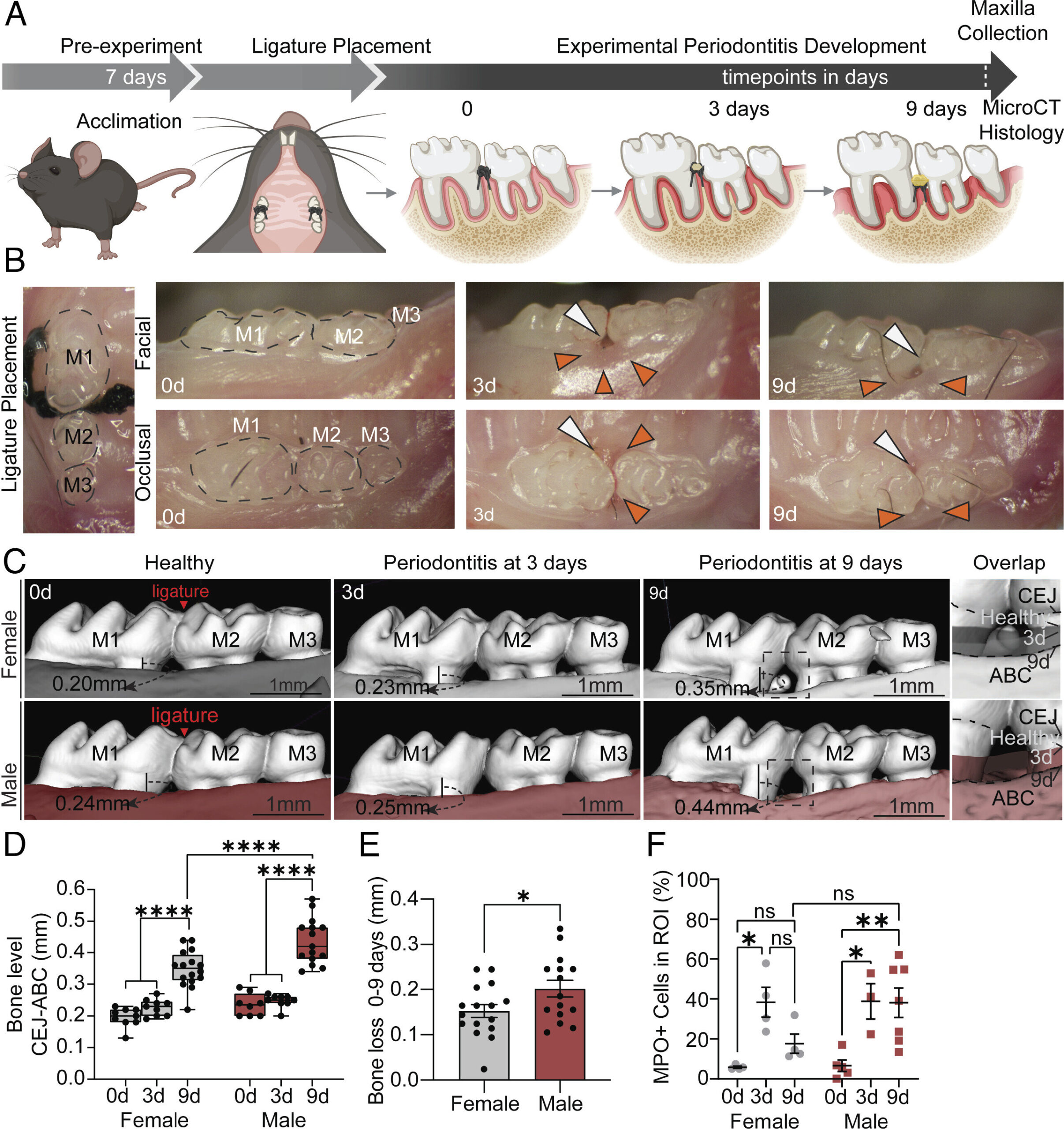 Descobriu-se que o inflamassoma provoca a perda óssea específica do homem na doença gengival
