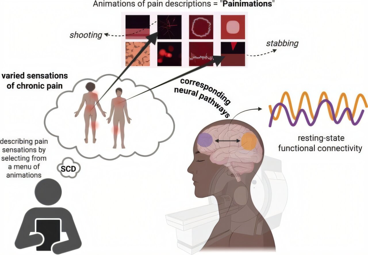 Dor da doença falciforme destacada com aplicativo recém-desenvolvido