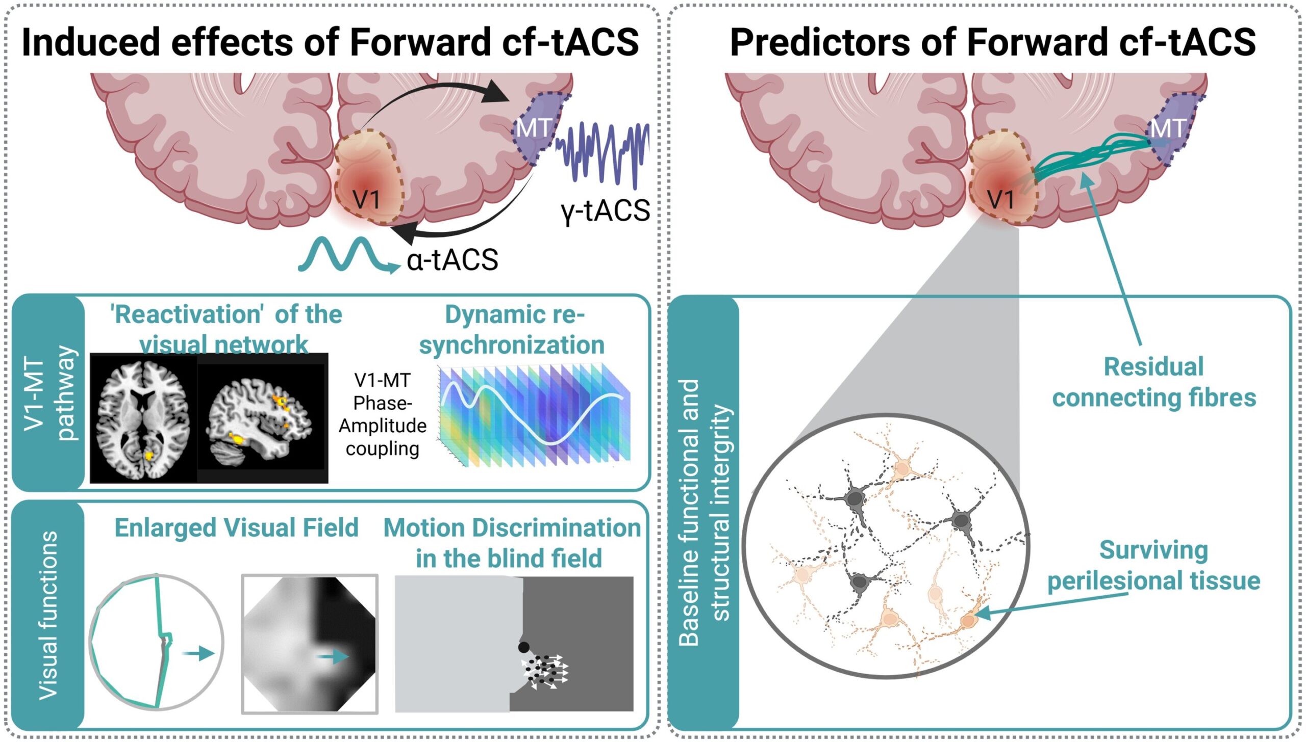 Estimulação cerebral melhora a recuperação da visão após acidente vascular cerebral