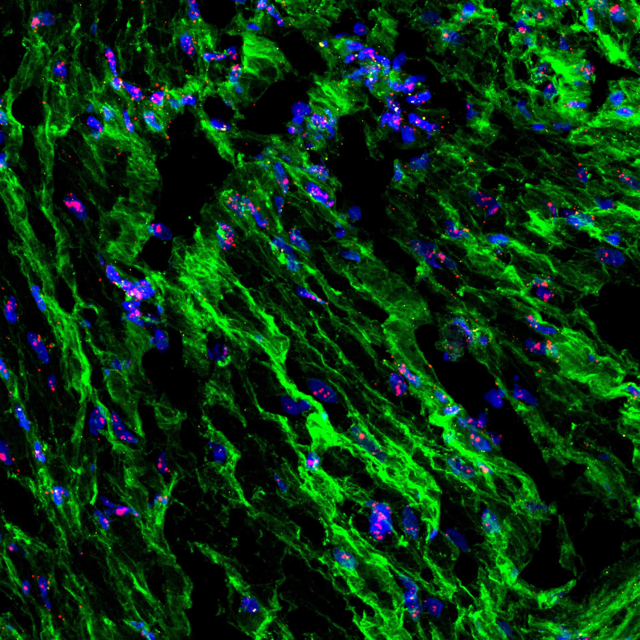 Estudo revela como as contrações uterinas são reguladas pelo estiramento e pressão durante o parto