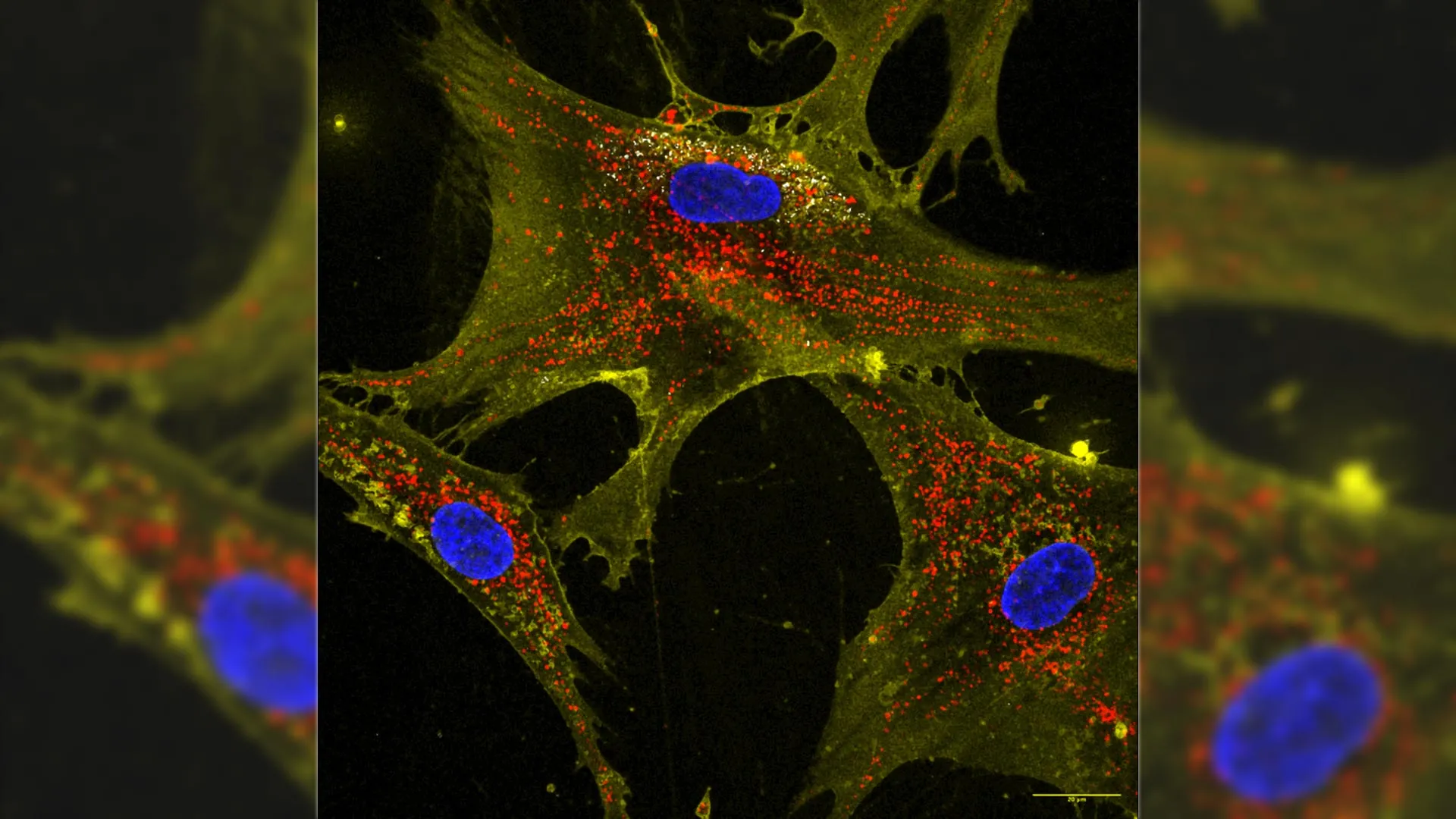 Nanoflores sobrecarregam células-tronco para recarregar células envelhecidas