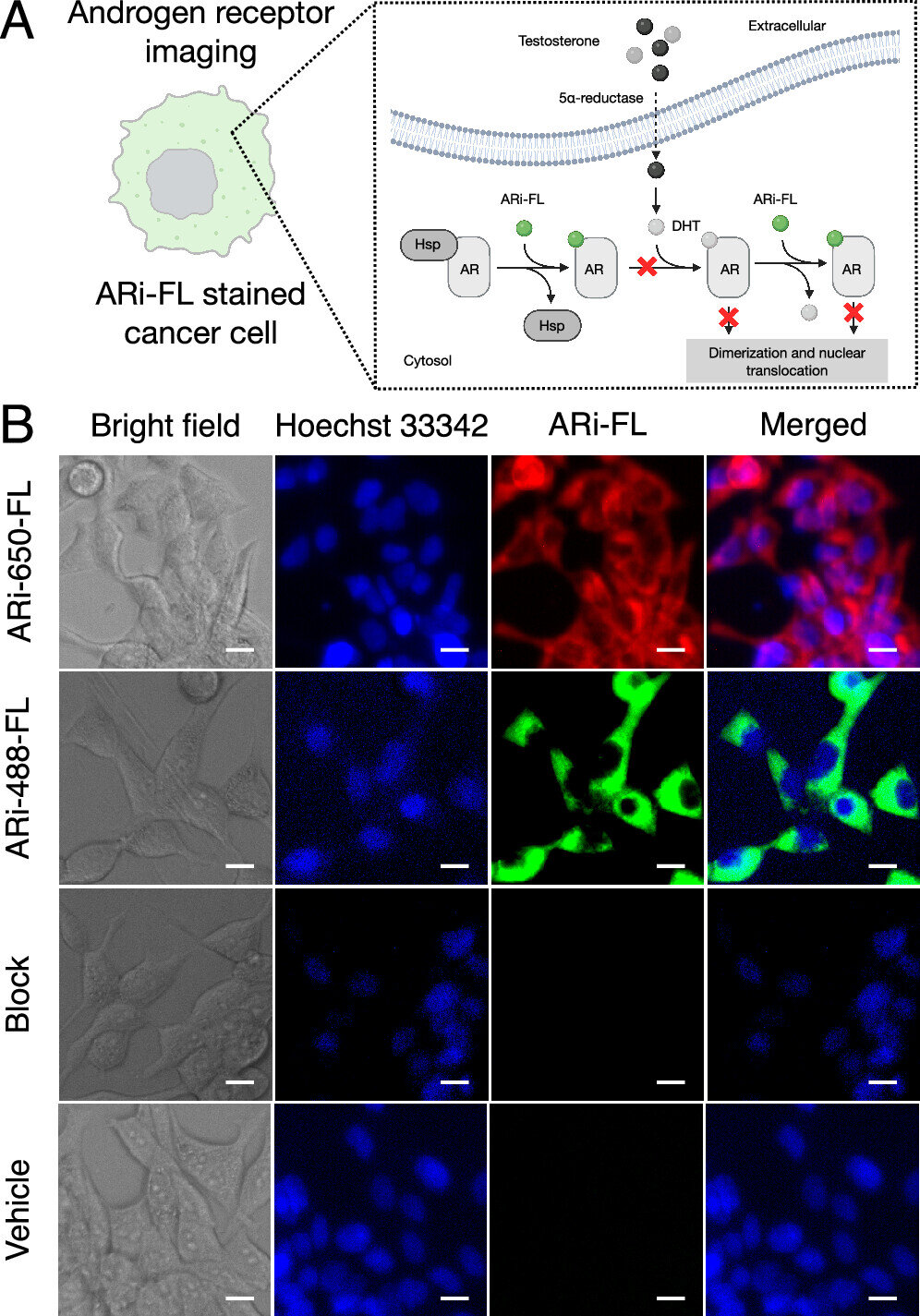 Nova sonda de imagem ajuda a rastrear o câncer de próstata e possivelmente tratá-lo antes que a resistência se desenvolva